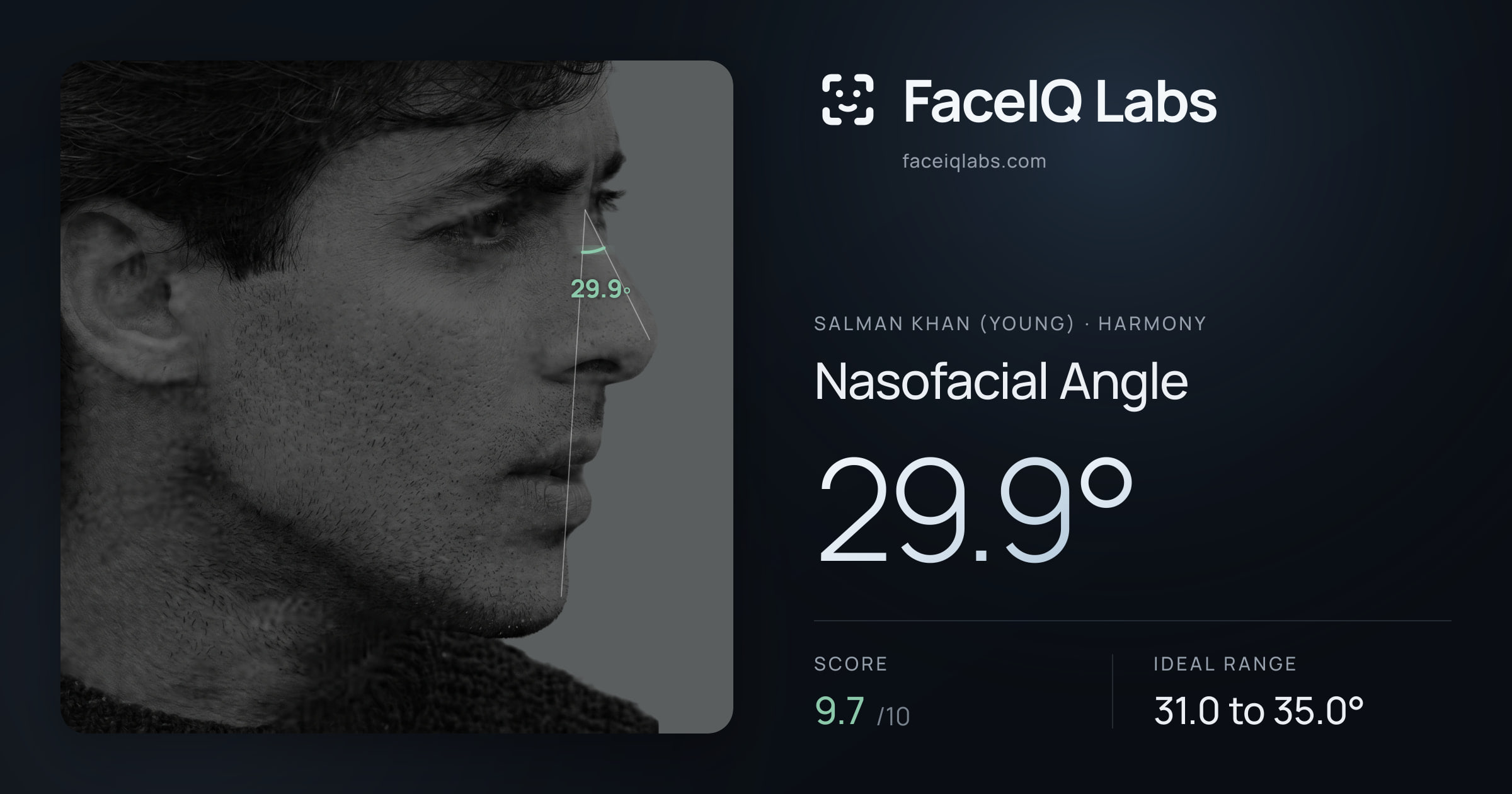 Salman Khan (Young) Nasofacial Angle: 29.9°, drawn on the photo
