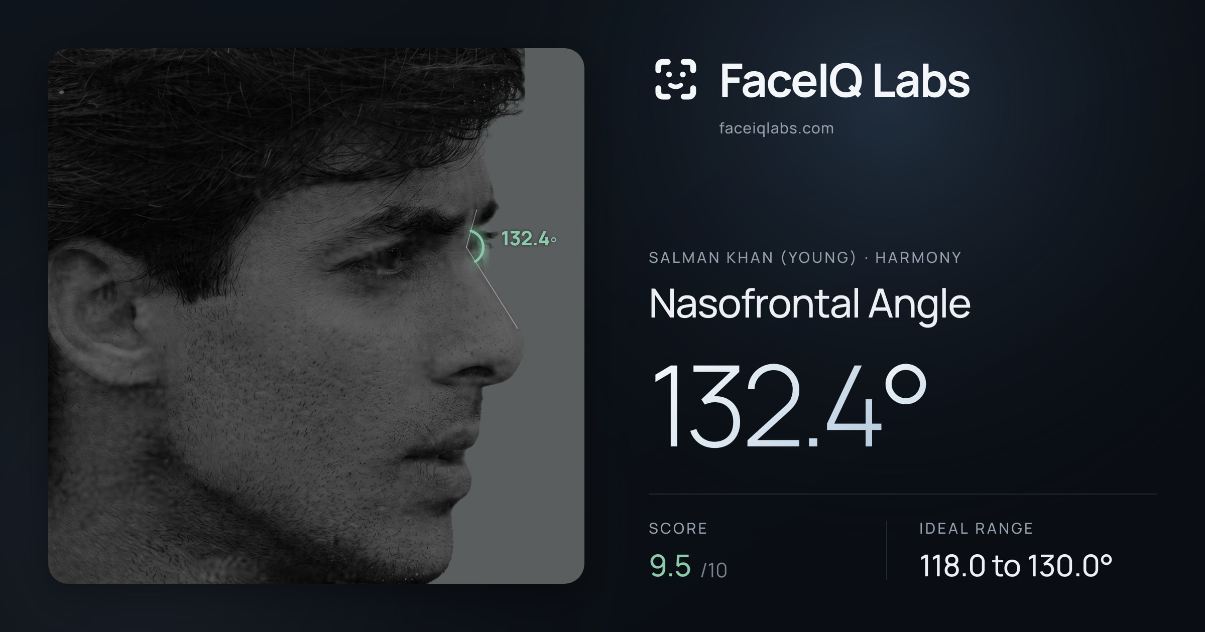 Salman Khan (Young) Nasofrontal Angle: 132.4°, drawn on the photo