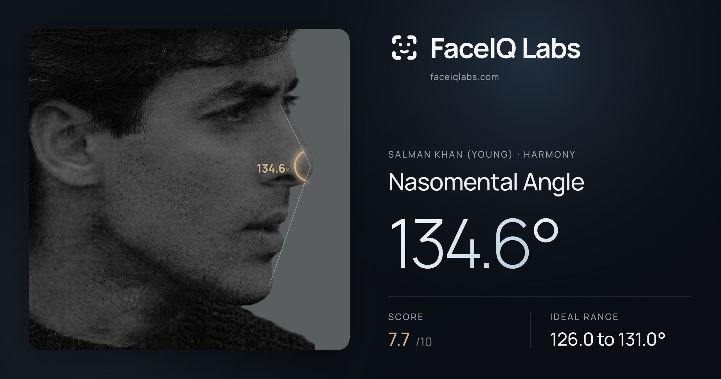 Salman Khan (Young) Nasomental Angle: 134.6°, drawn on the photo