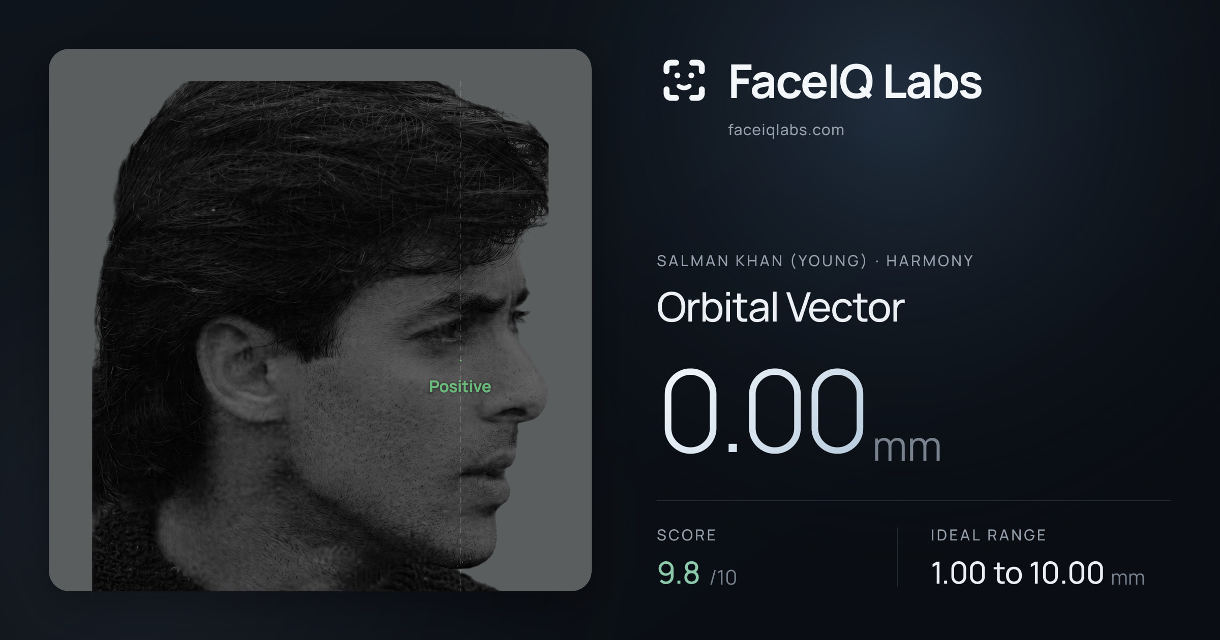 Salman Khan (Young) Orbital Vector: 0.00mm, drawn on the photo