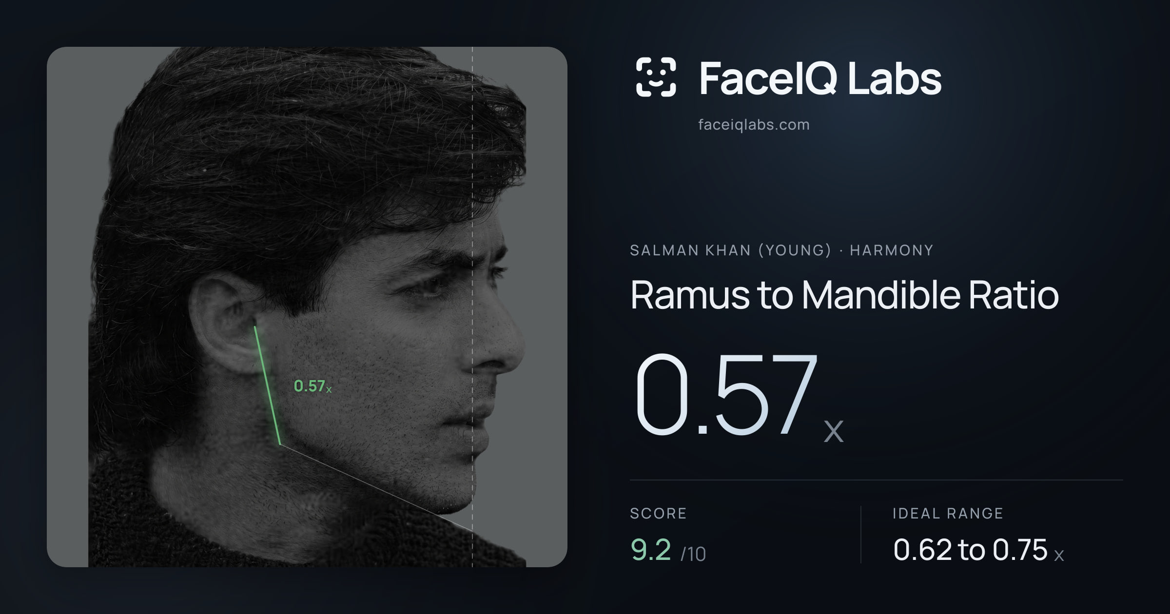 Salman Khan (Young) Ramus to Mandible Ratio: 0.57x, drawn on the photo