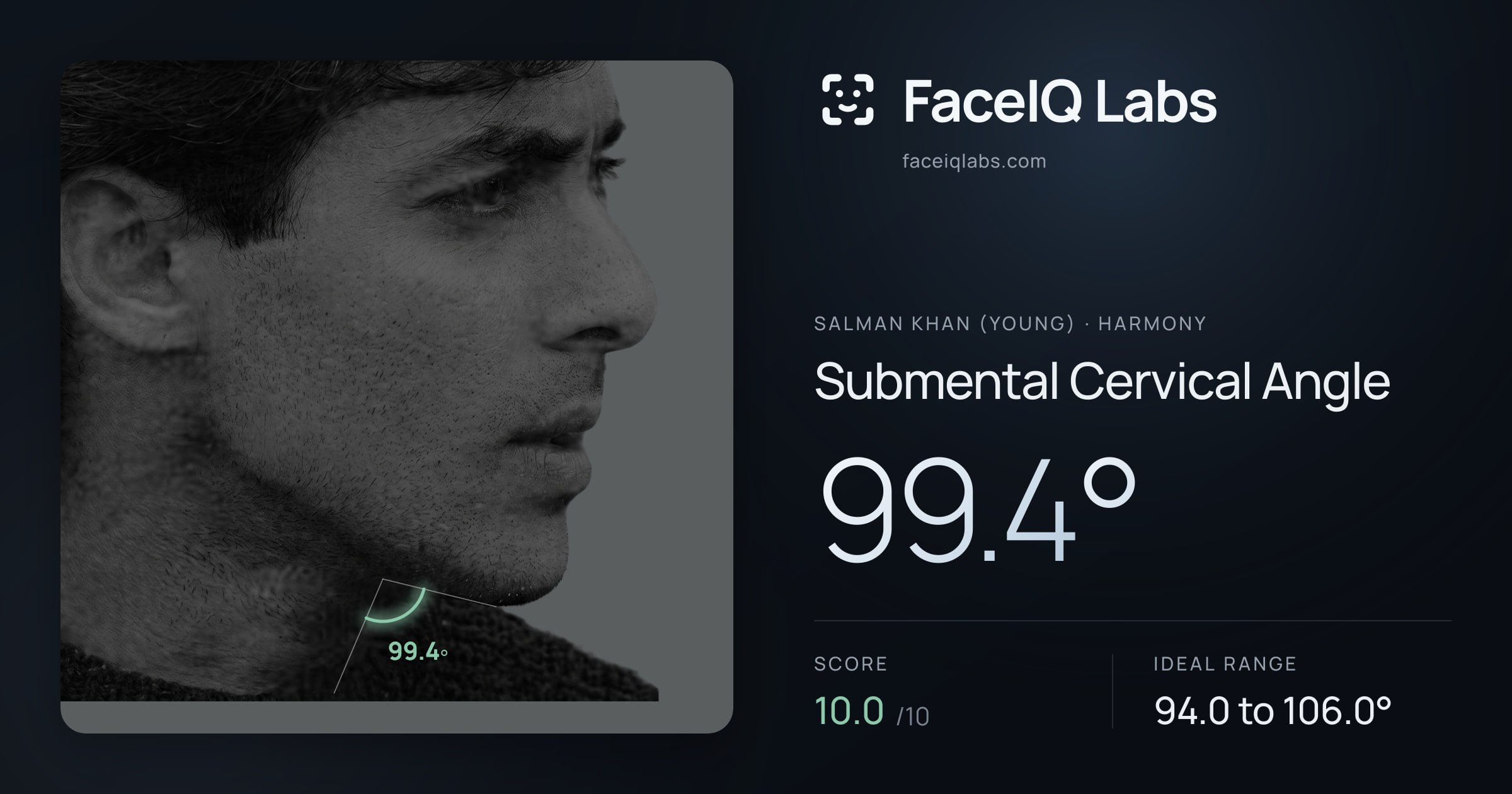 Salman Khan (Young) Submental Cervical Angle: 99.4°, drawn on the photo