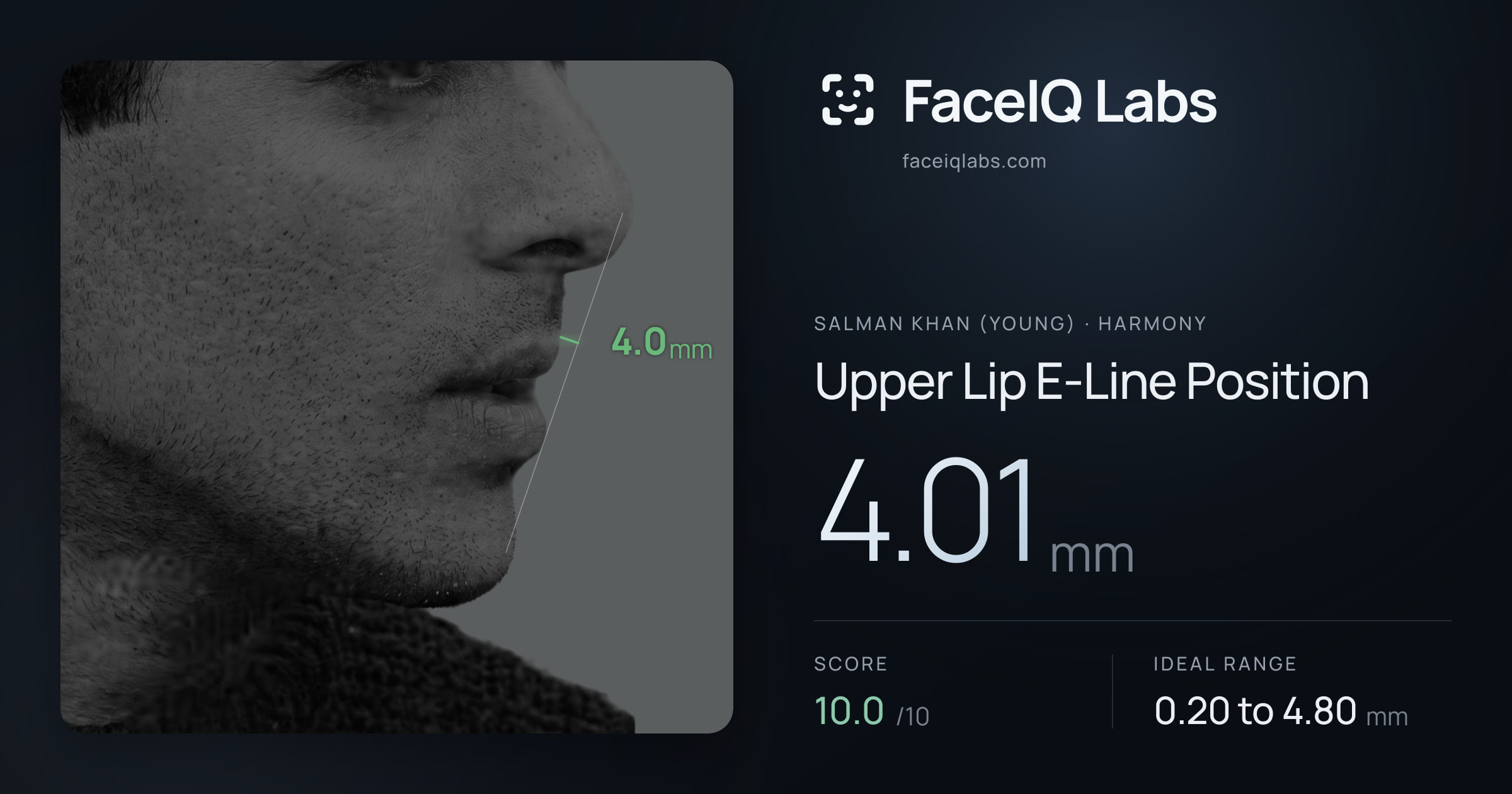 Salman Khan (Young) Upper Lip E-Line Position: 4.01mm, drawn on the photo