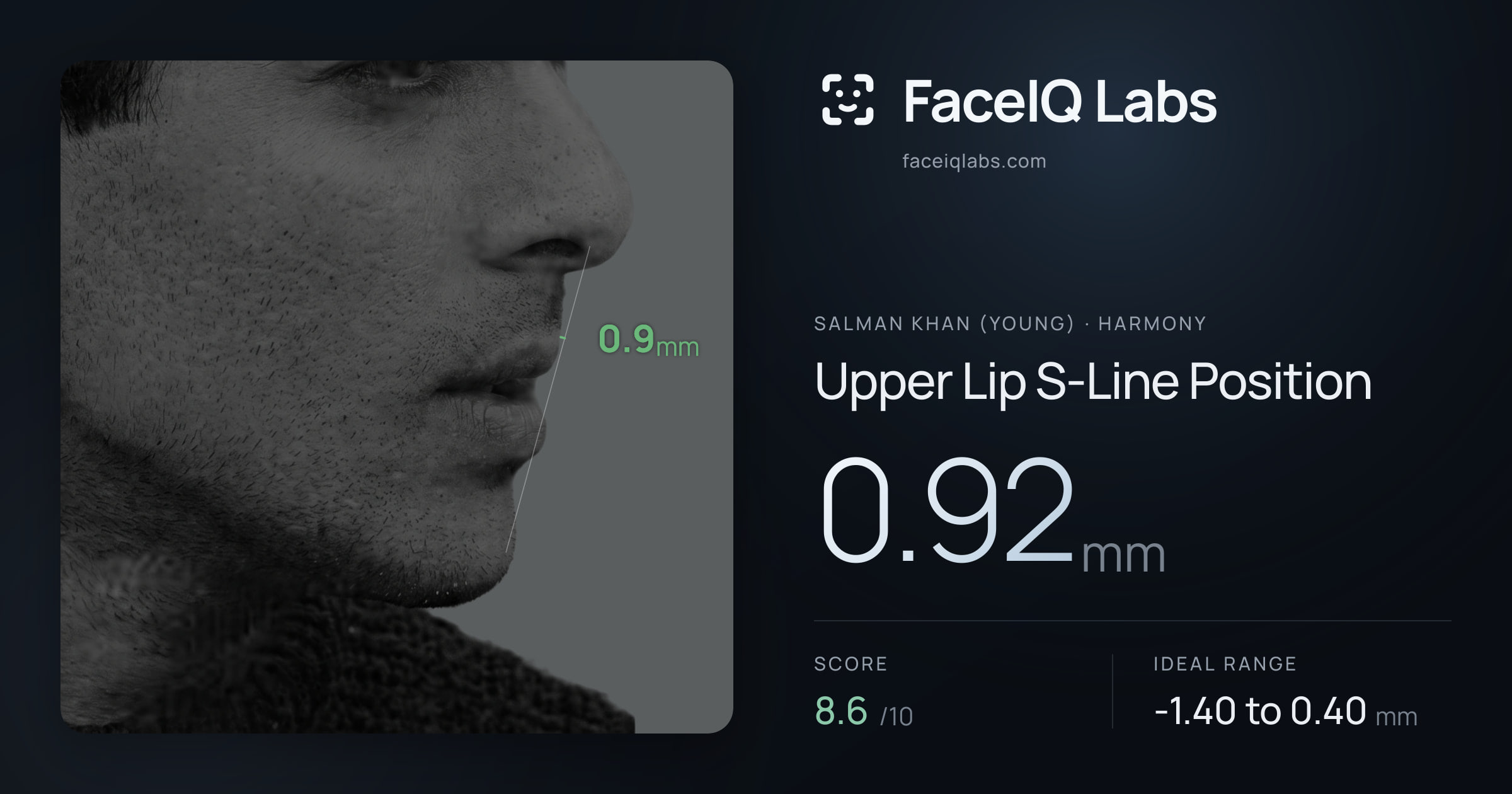 Salman Khan (Young) Upper Lip S-Line Position: 0.92mm, drawn on the photo