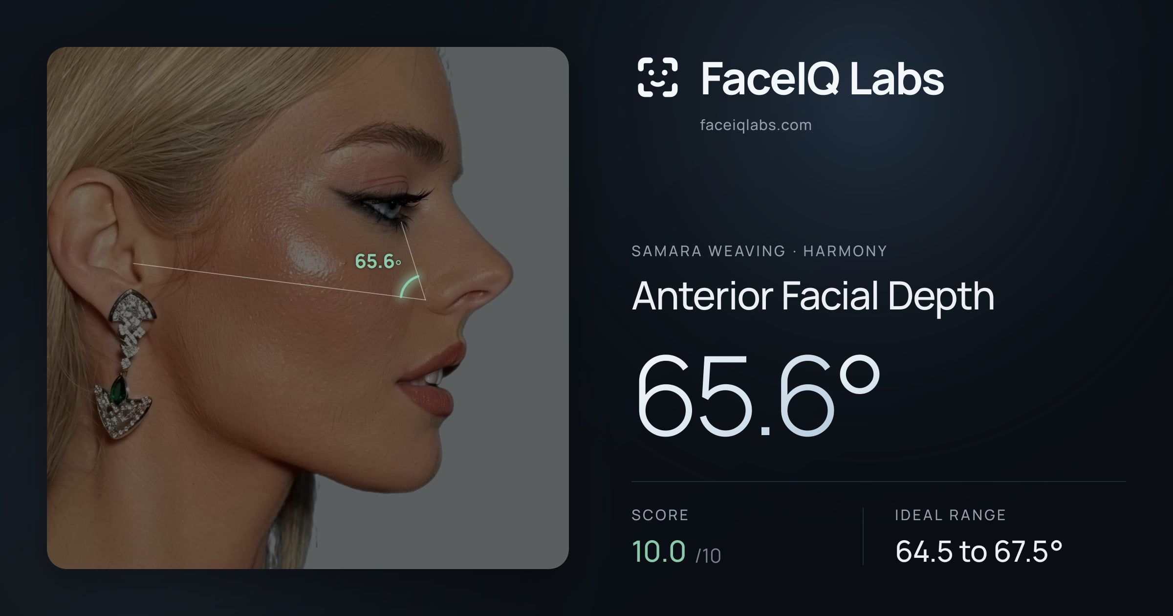 Samara Weaving Anterior Facial Depth: 65.6°, drawn on the photo