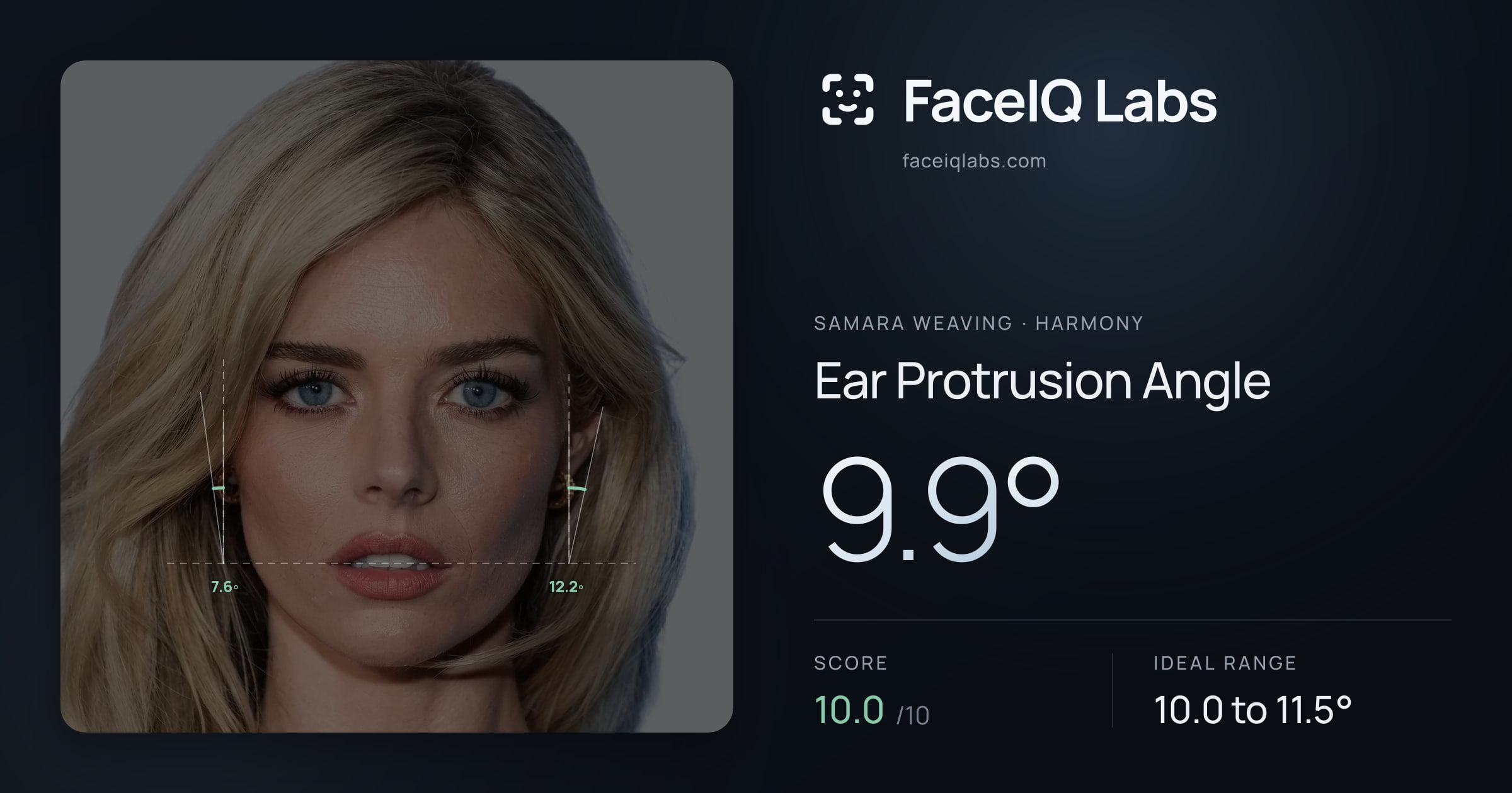 Samara Weaving Ear Protrusion Angle: 10.6°, drawn on the photo