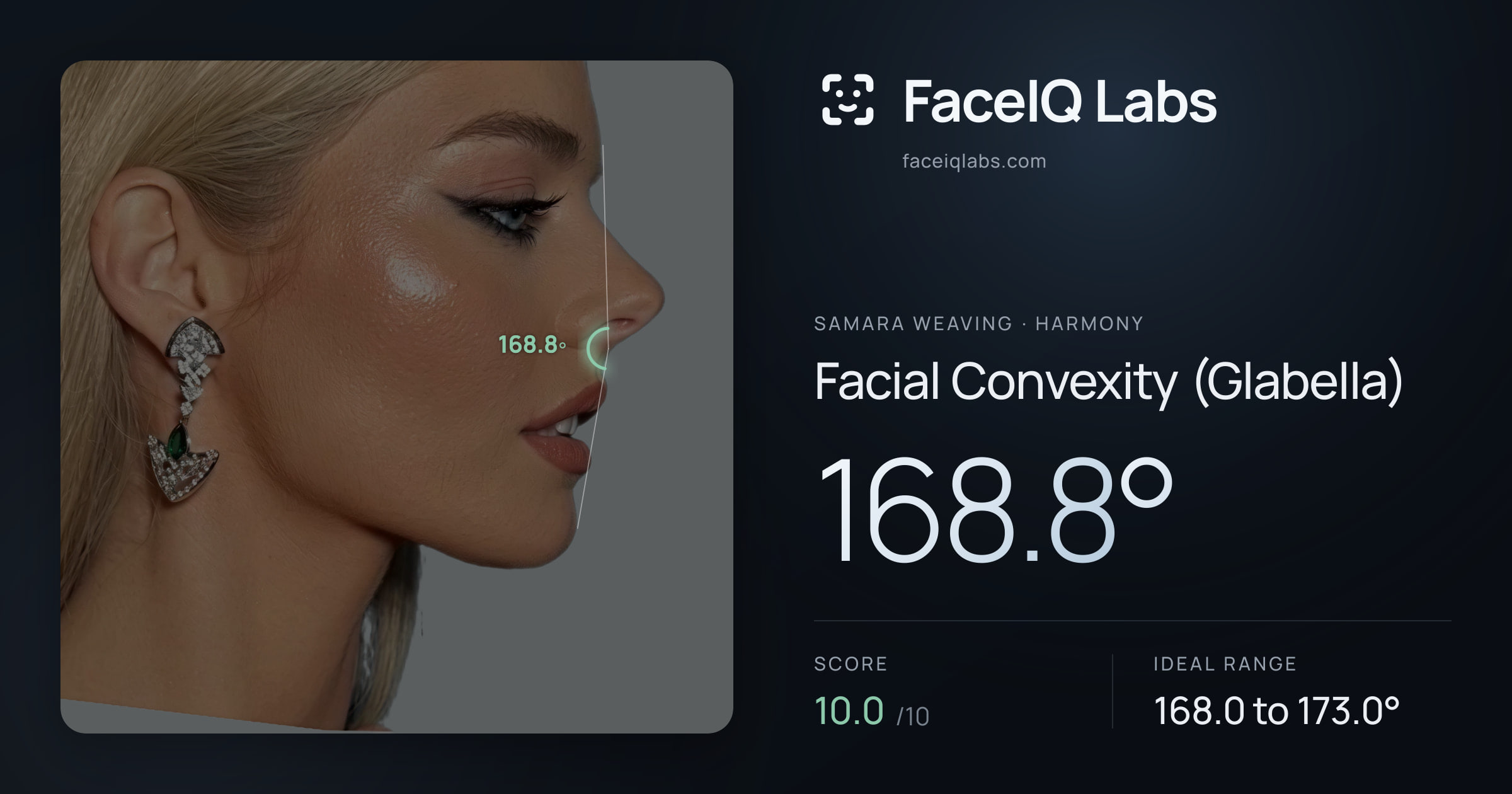 Samara Weaving Facial Convexity (Glabella): 168.8°, drawn on the photo