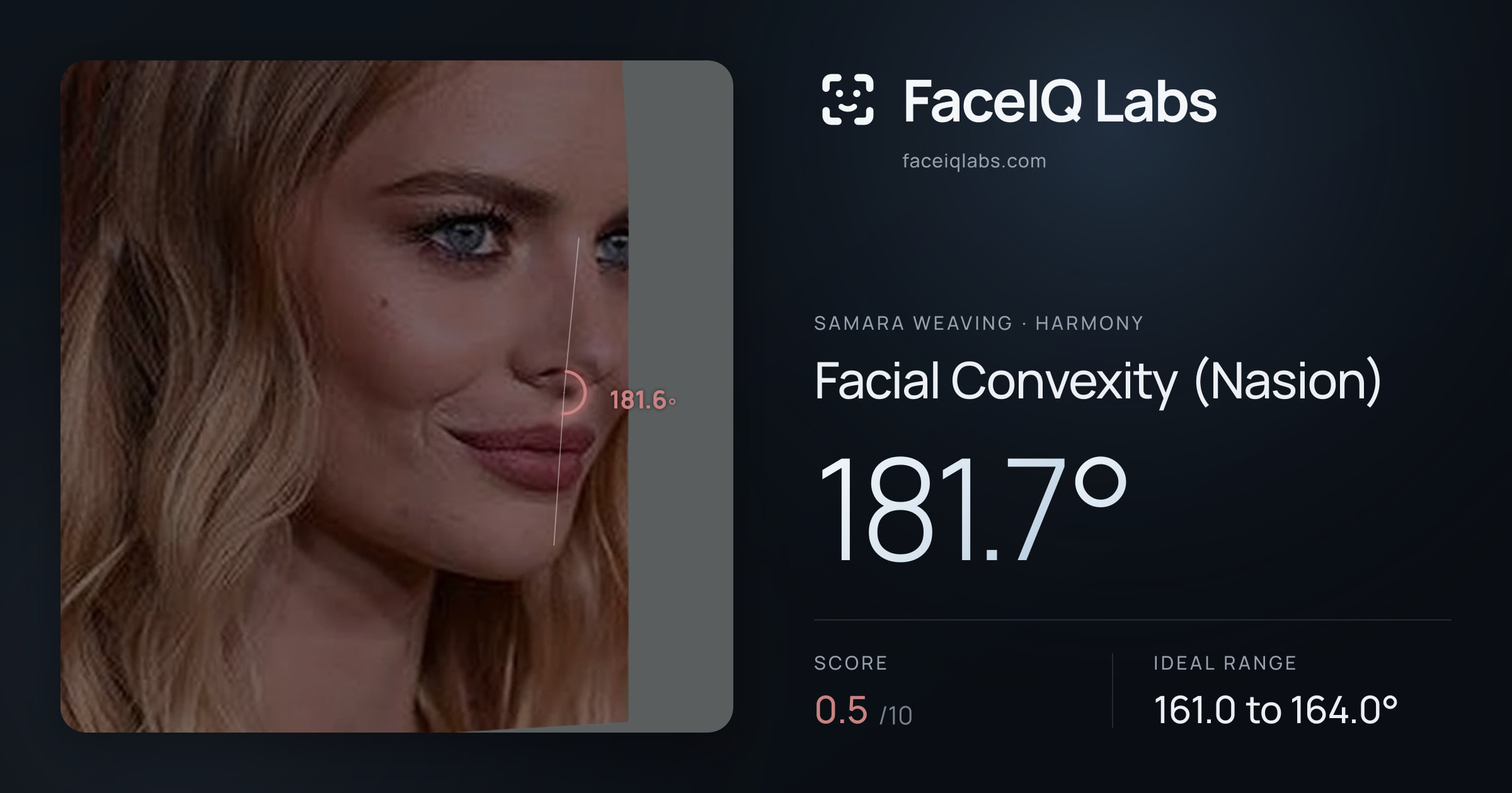 Samara Weaving Facial Convexity (Nasion): 181.7°, drawn on the photo