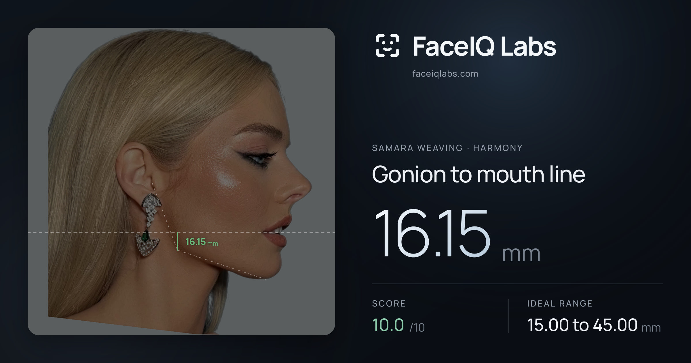 Samara Weaving Gonion to mouth line: 16.15mm, drawn on the photo