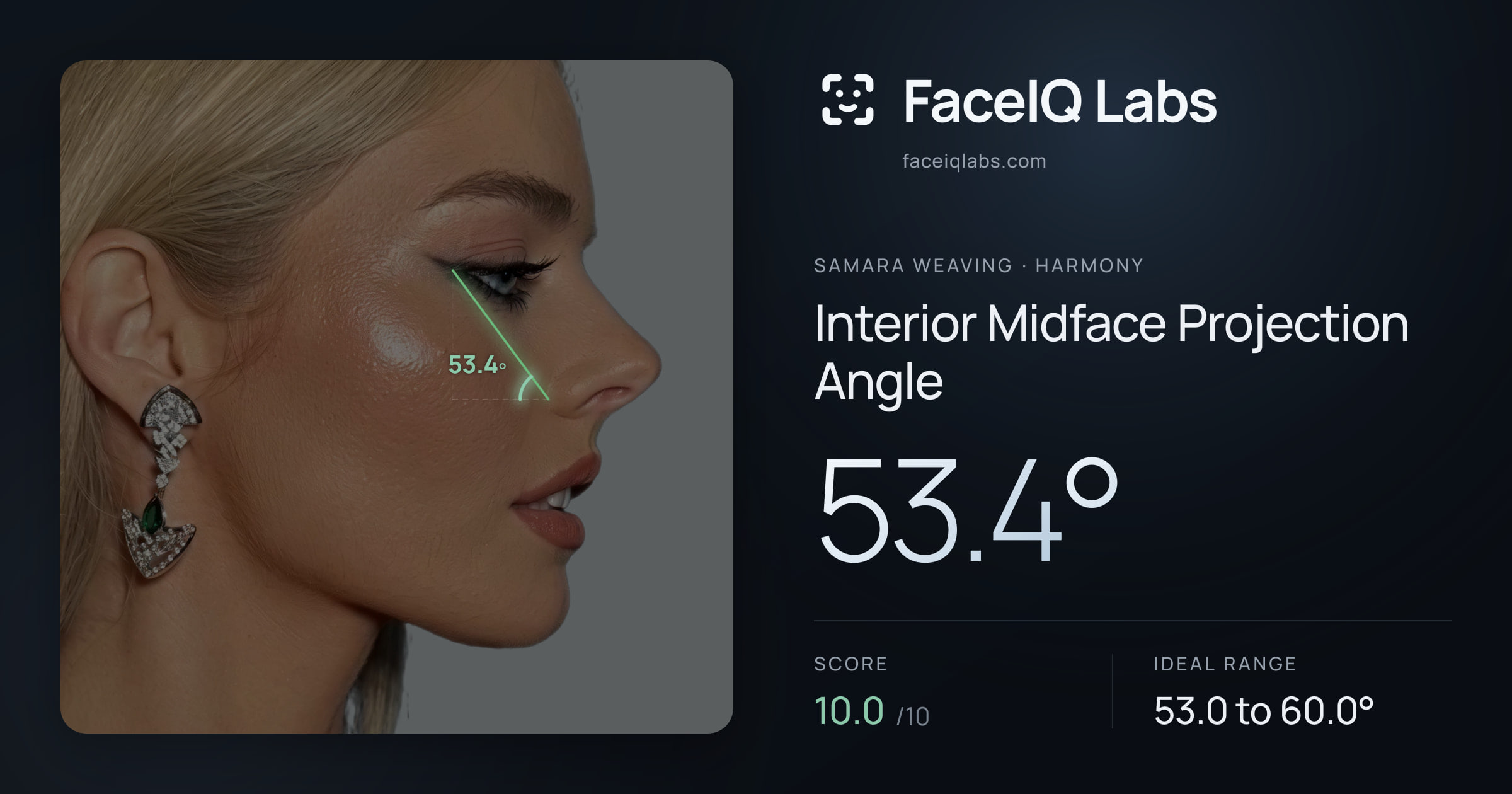 Samara Weaving Interior Midface Projection Angle: 54.3°, drawn on the photo