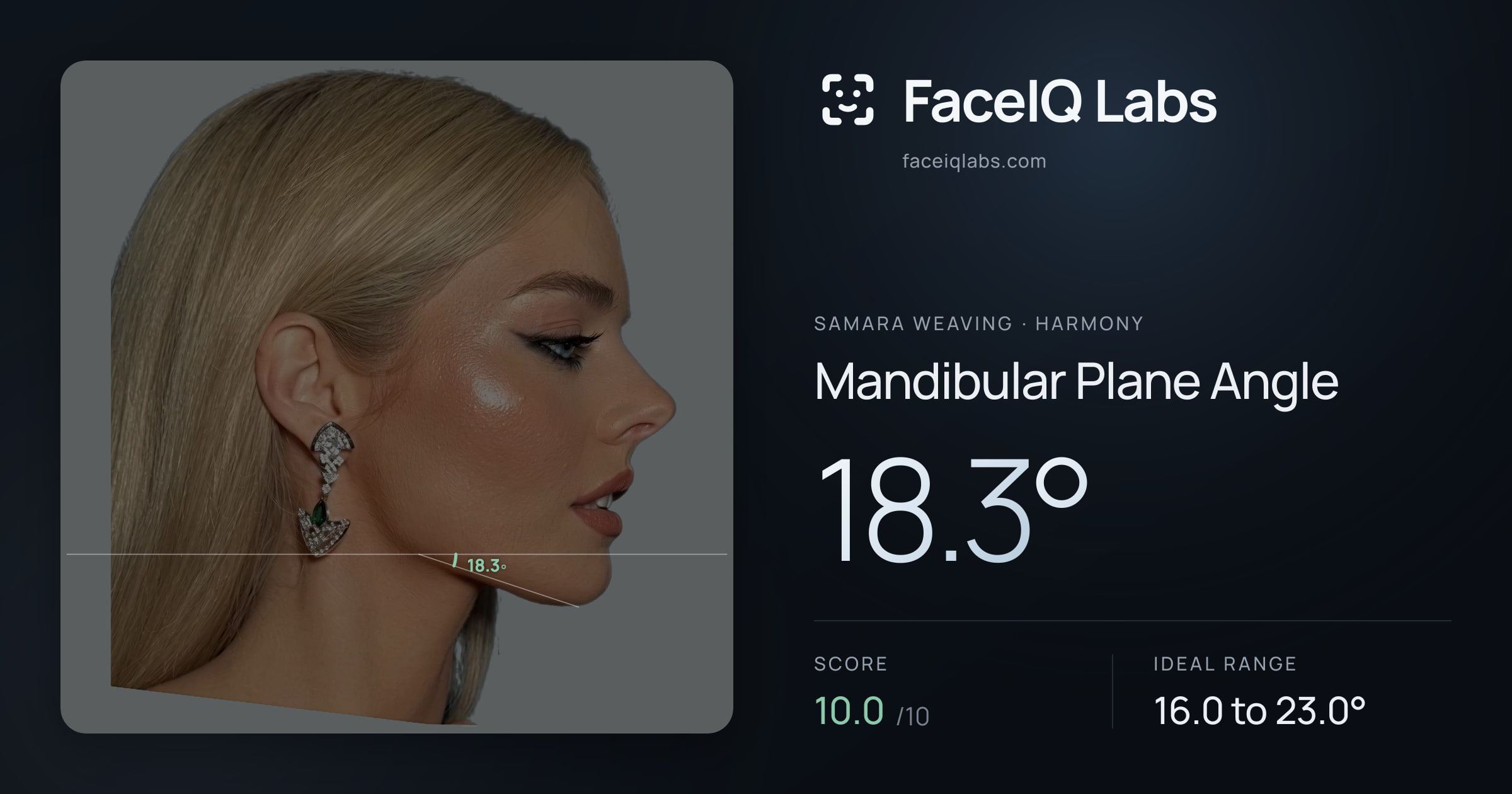 Samara Weaving Mandibular Plane Angle: 18.3°, drawn on the photo
