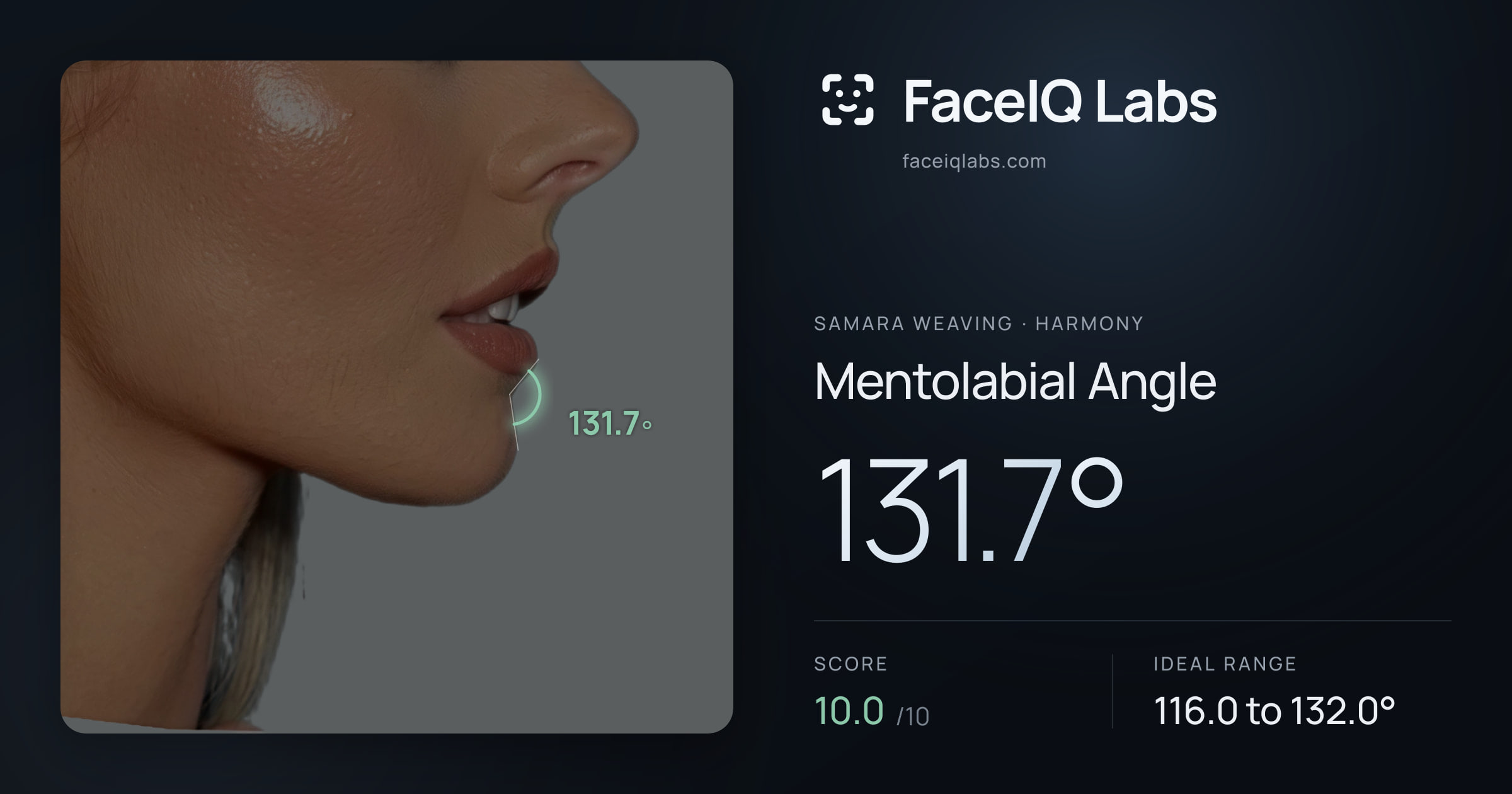 Samara Weaving Mentolabial Angle: 131.7°, drawn on the photo