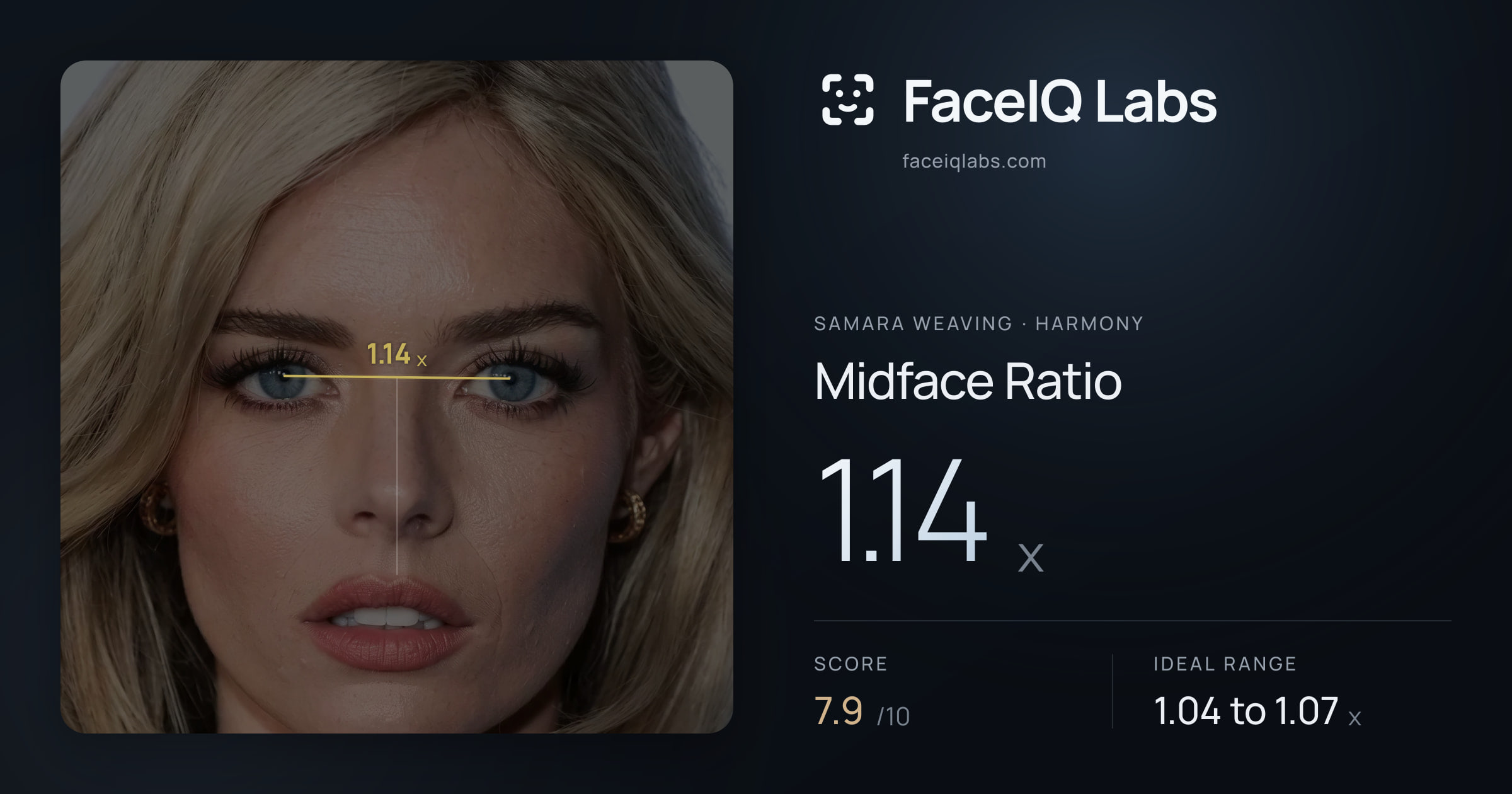 Samara Weaving Midface Ratio: 1.14x, drawn on the photo