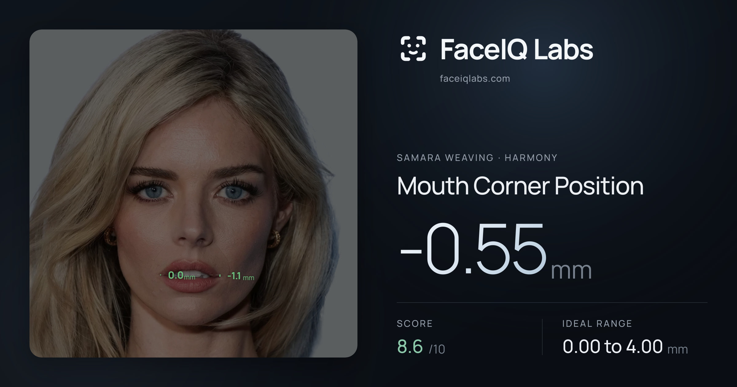 Samara Weaving Mouth Corner Position: 4.92mm, drawn on the photo
