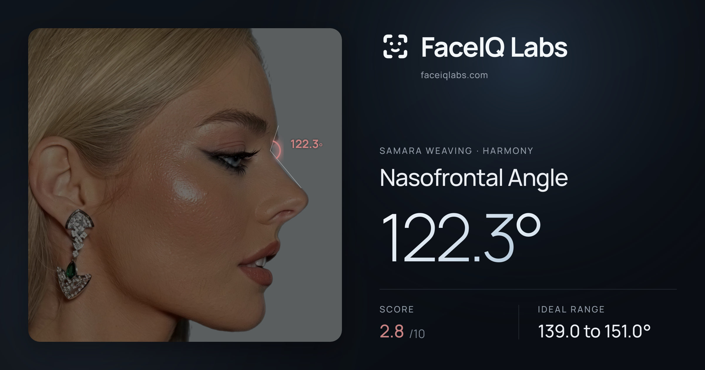 Samara Weaving Nasofrontal Angle: 122.3°, drawn on the photo