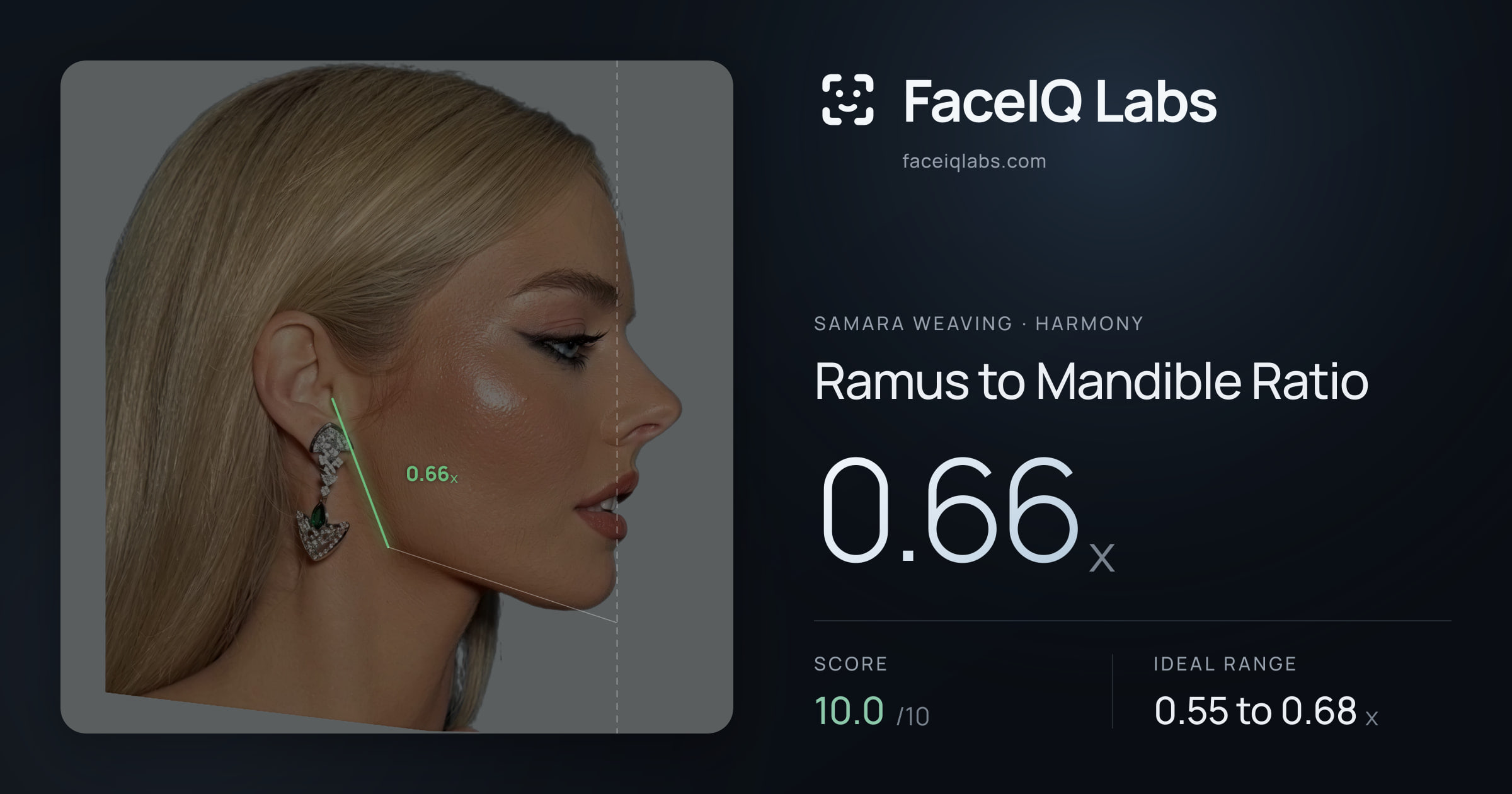 Samara Weaving Ramus to Mandible Ratio: 0.66x, drawn on the photo