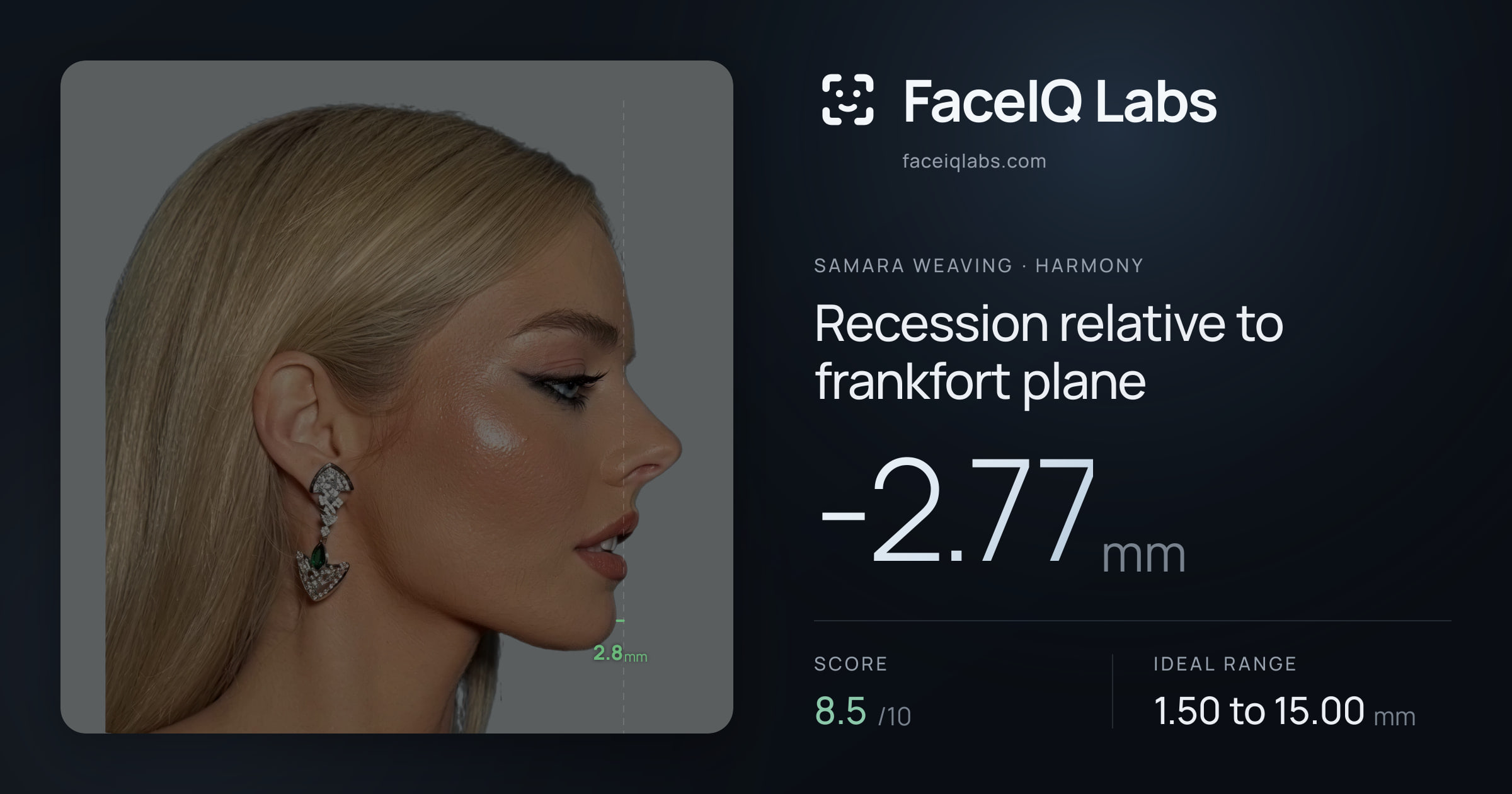 Samara Weaving Recession relative to frankfort plane: -8.38mm, drawn on the photo