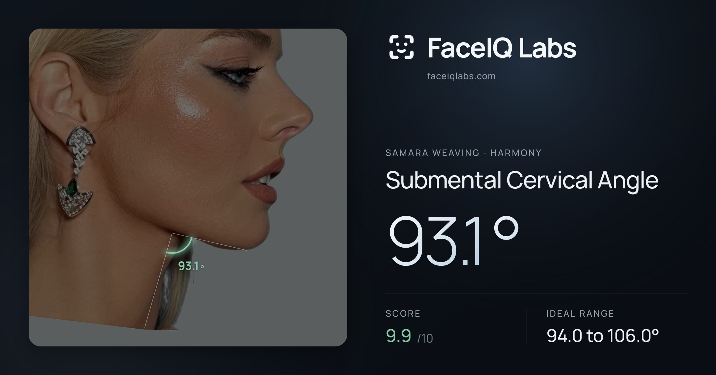 Samara Weaving Submental Cervical Angle: 93.1°, drawn on the photo