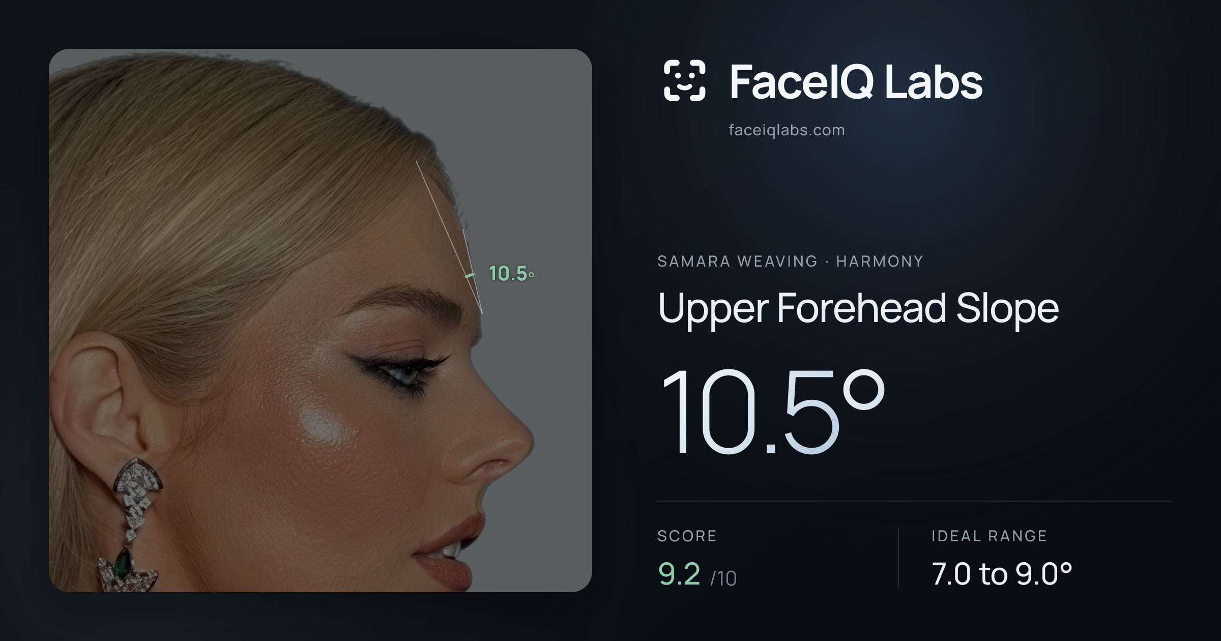 Samara Weaving Upper Forehead Slope: 6.6°, drawn on the photo