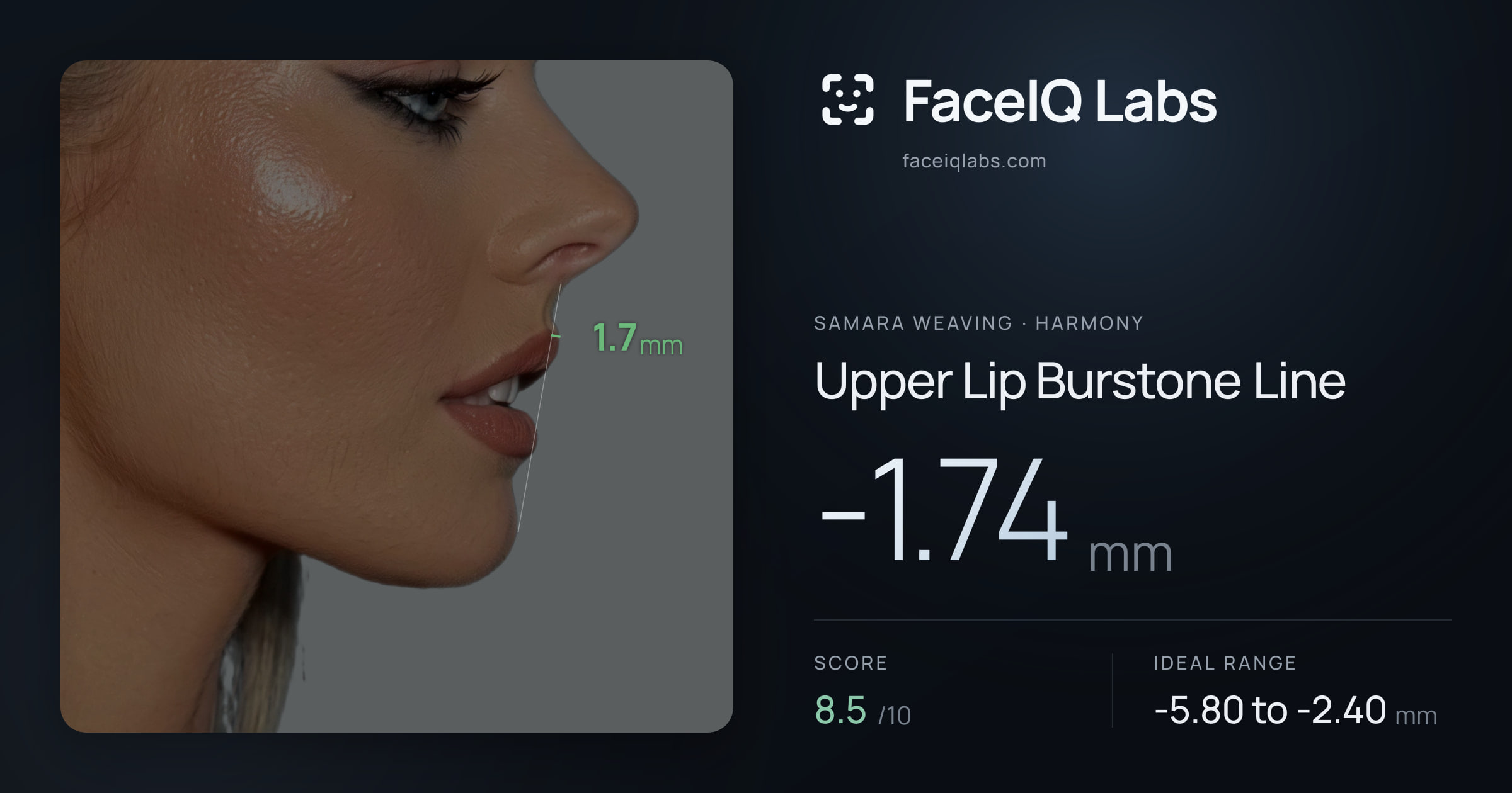 Samara Weaving Upper Lip Burstone Line: -1.74mm, drawn on the photo