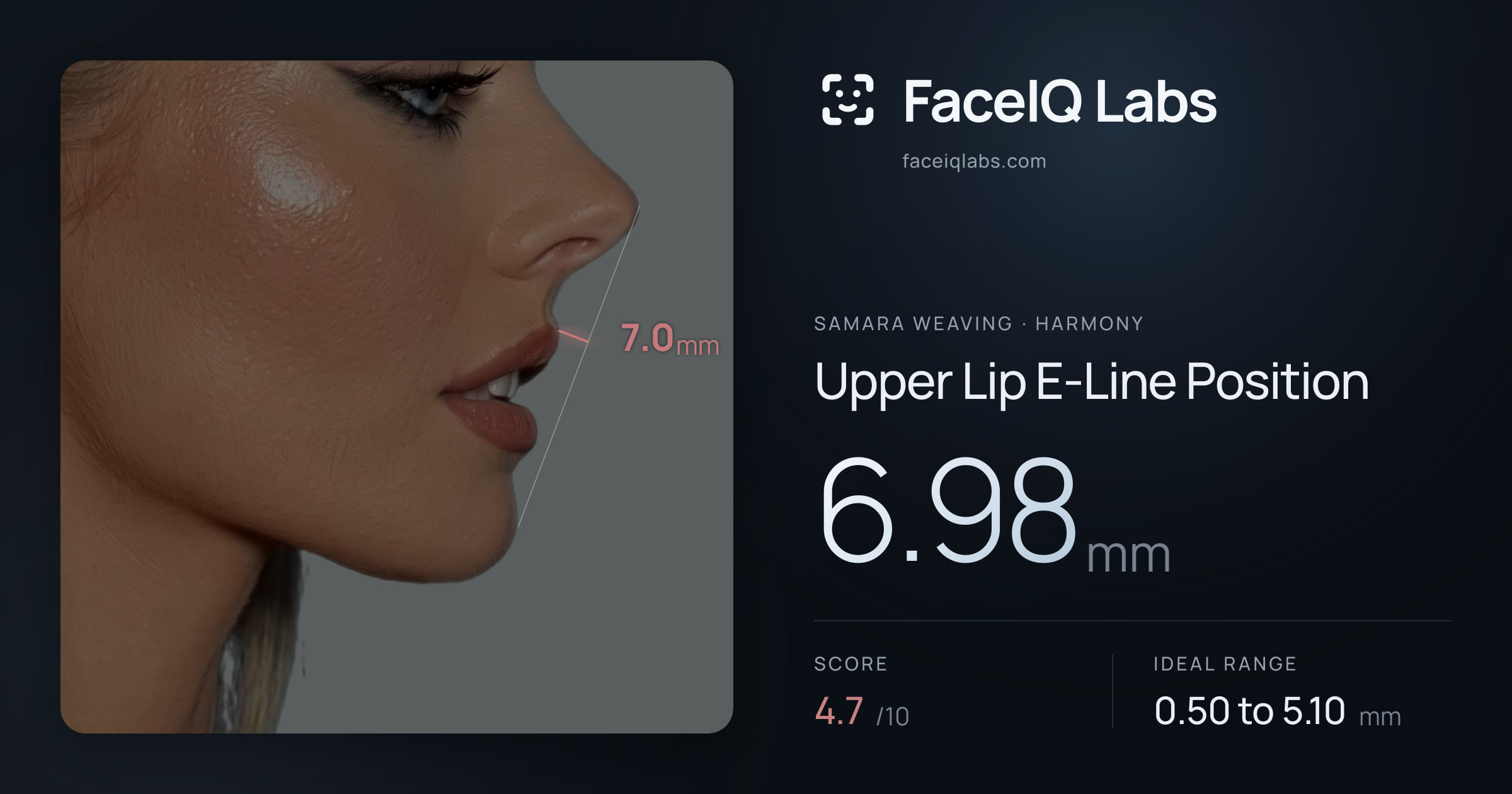 Samara Weaving Upper Lip E-Line Position: 6.98mm, drawn on the photo
