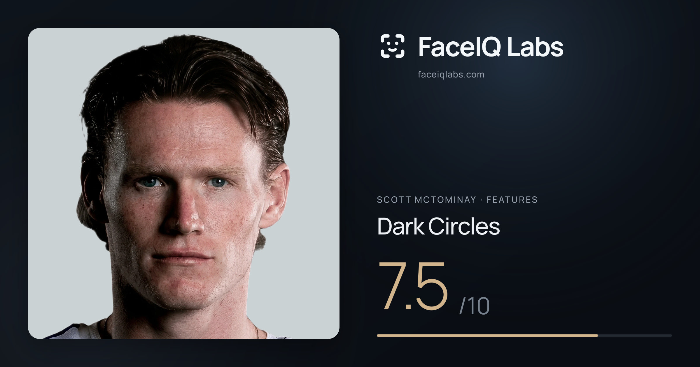 Scott Mctominay Dark Circles: 7.5/10, drawn on the photo