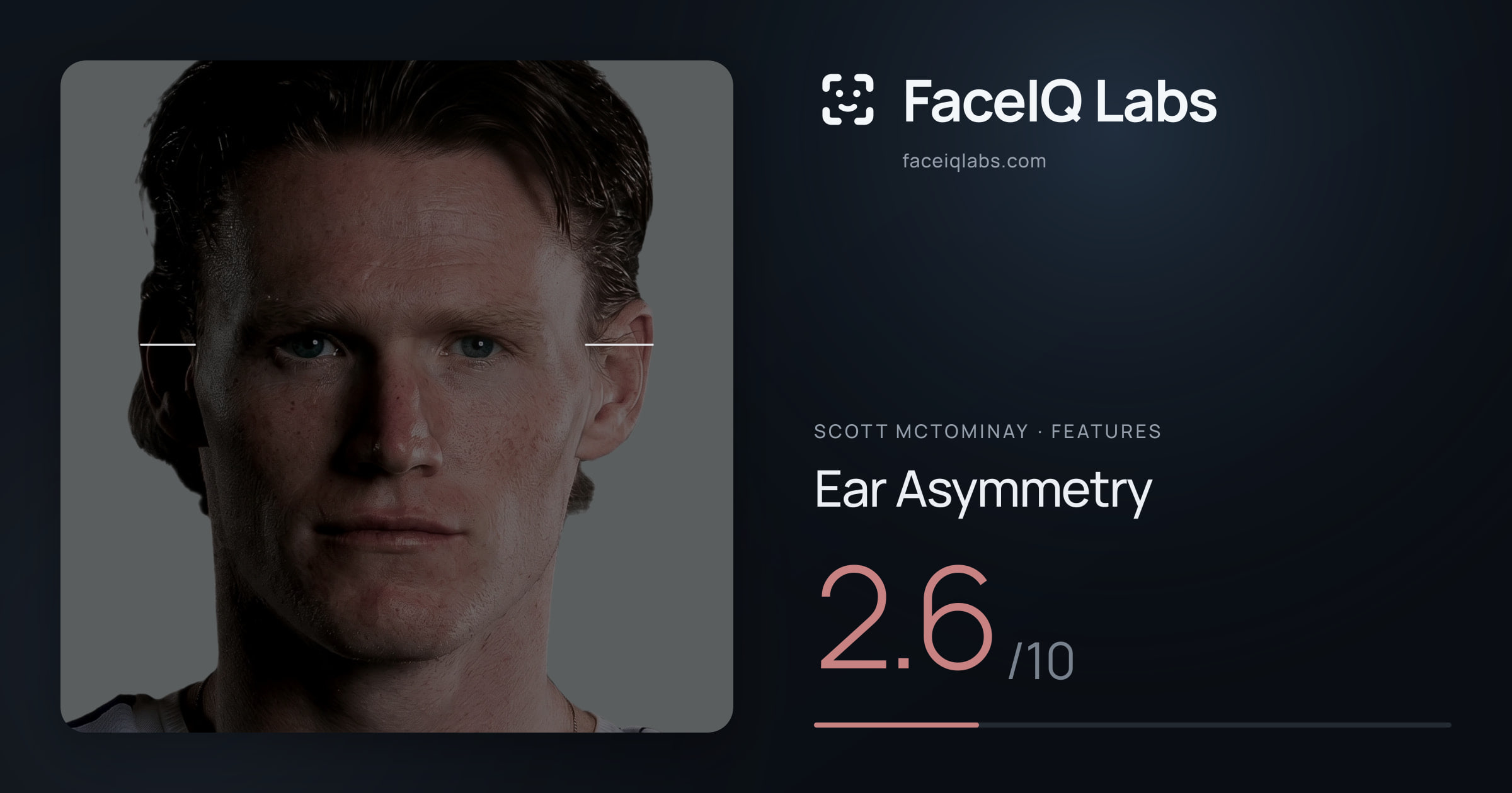 Scott Mctominay Ear Asymmetry: 2.6/10, drawn on the photo