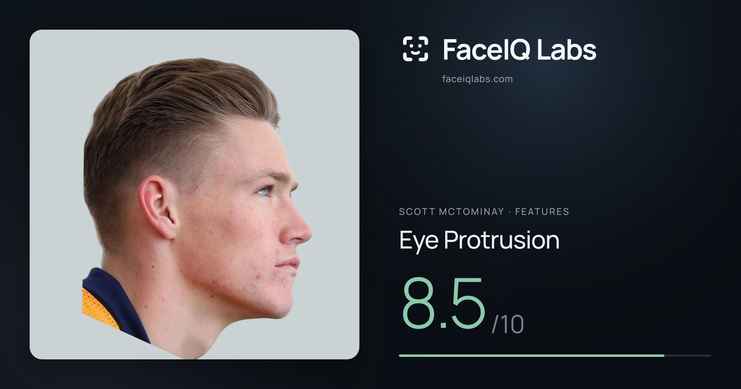 Scott Mctominay Eye Protrusion: 8.5/10, drawn on the photo