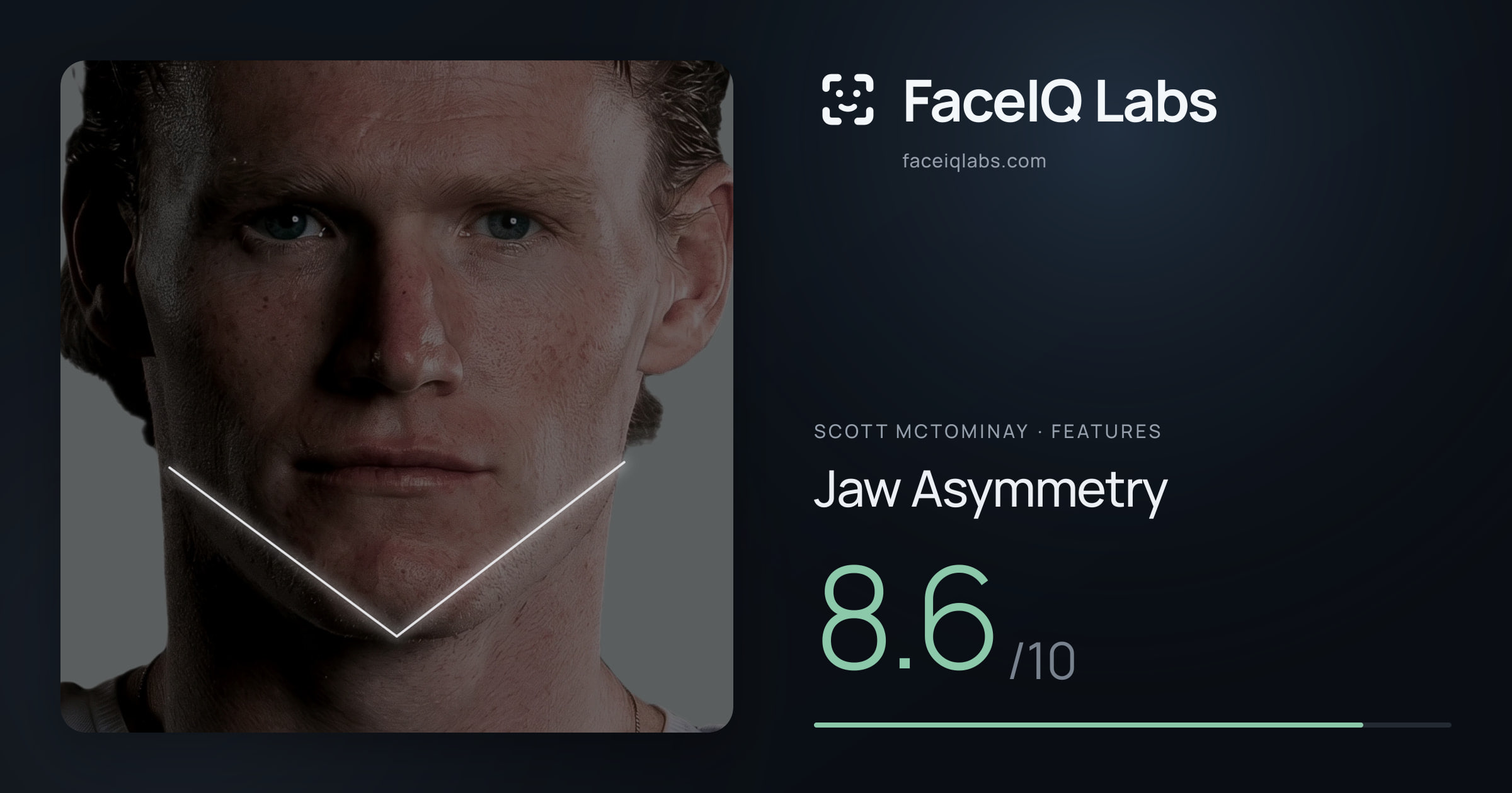 Scott Mctominay Jaw Asymmetry: 8.6/10, drawn on the photo