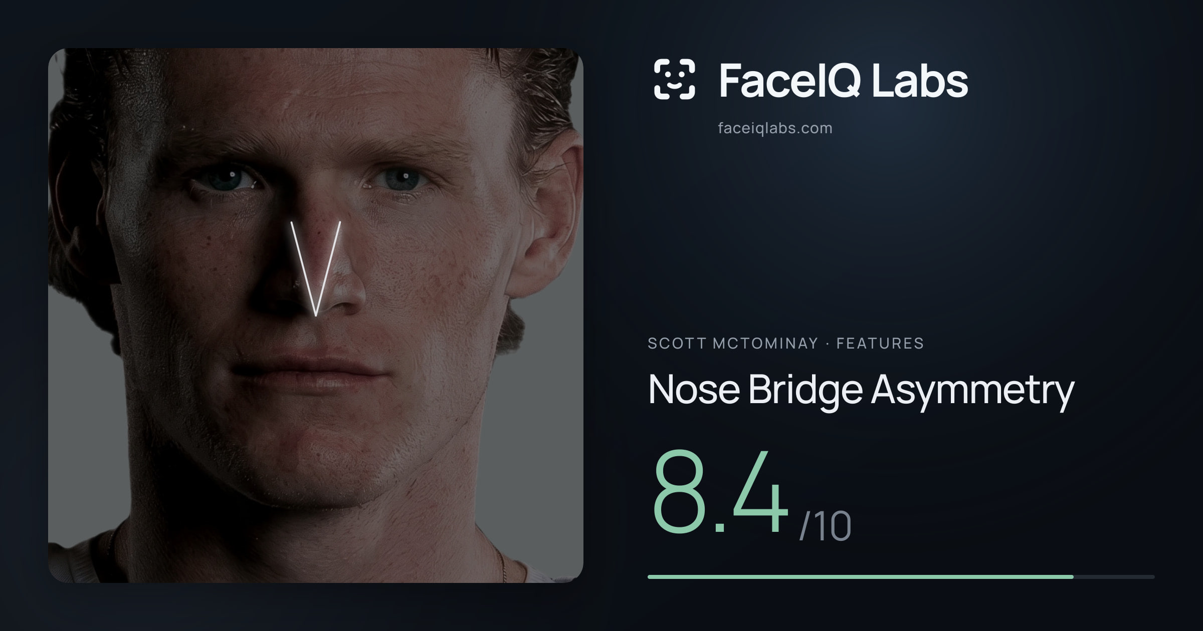 Scott Mctominay Nose Bridge Asymmetry: 8.4/10, drawn on the photo
