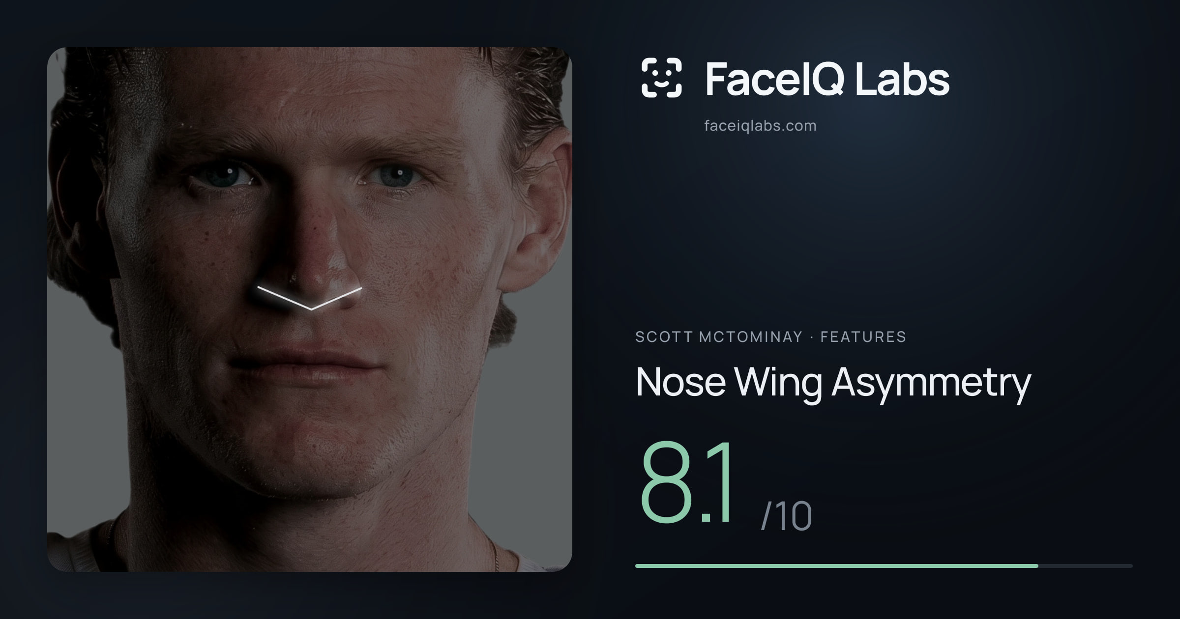 Scott Mctominay Nose Wing Asymmetry: 8.1/10, drawn on the photo