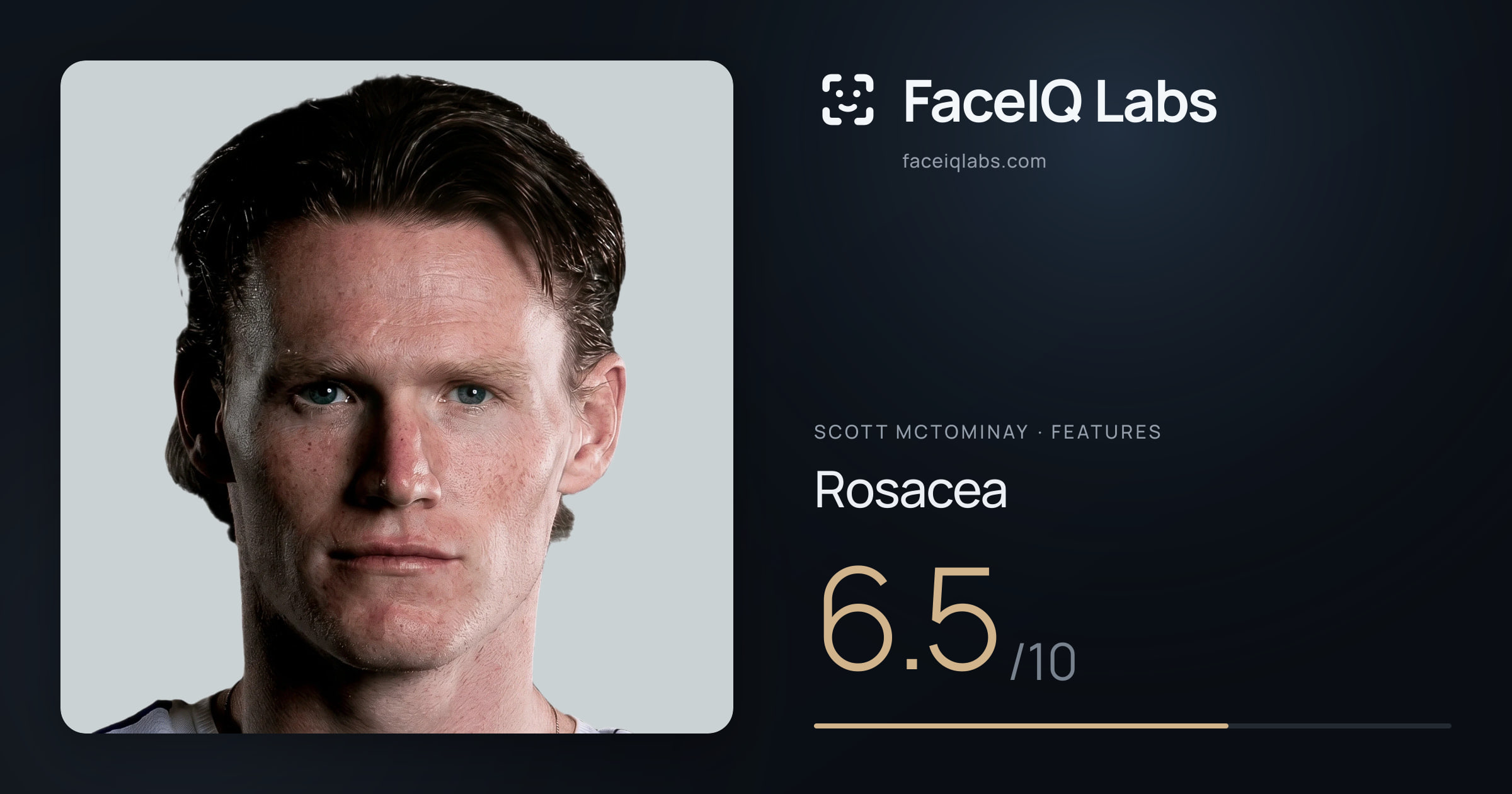 Scott Mctominay Rosacea: 6.5/10, drawn on the photo