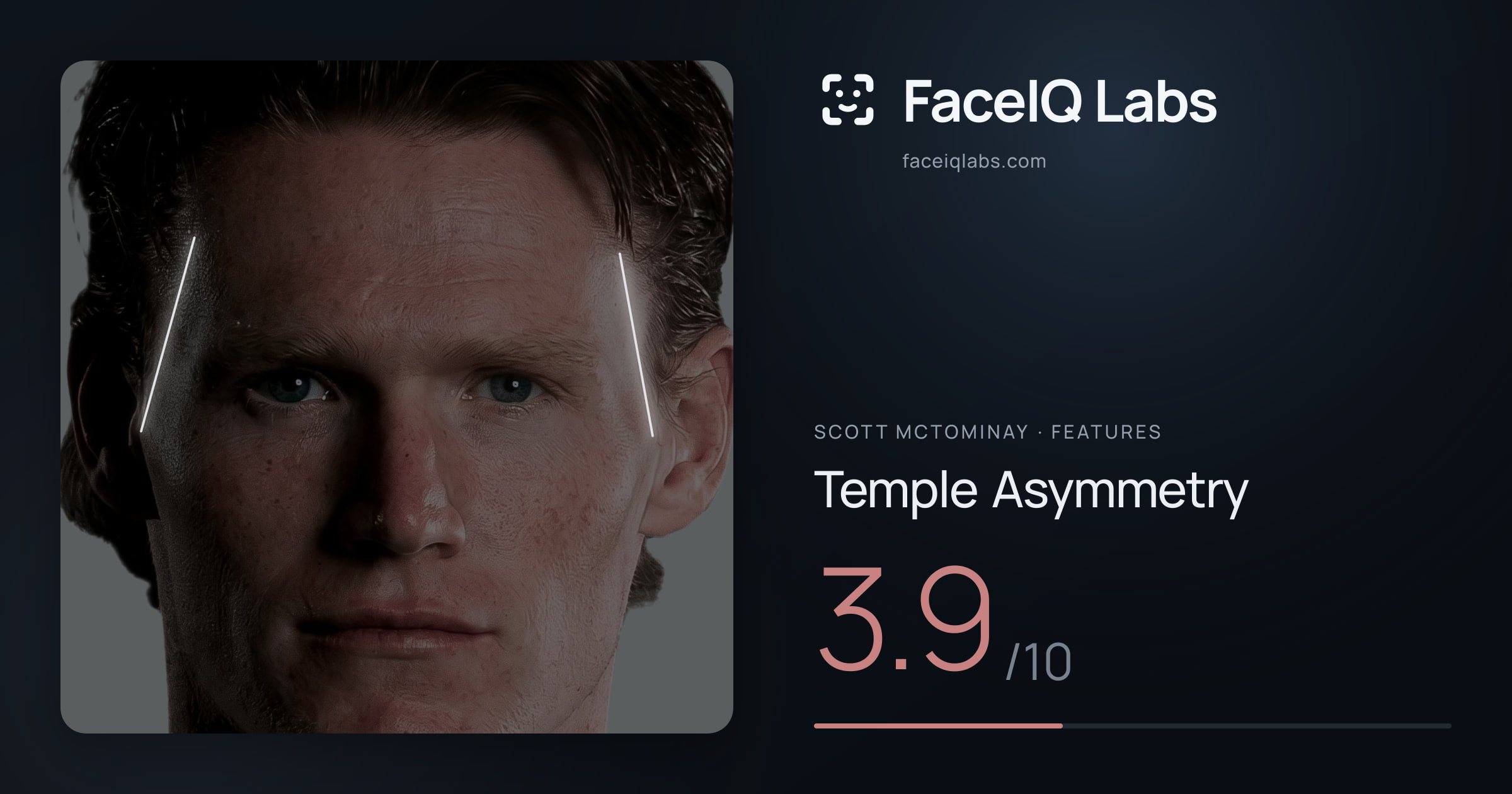 Scott Mctominay Temple Asymmetry: 3.9/10, drawn on the photo