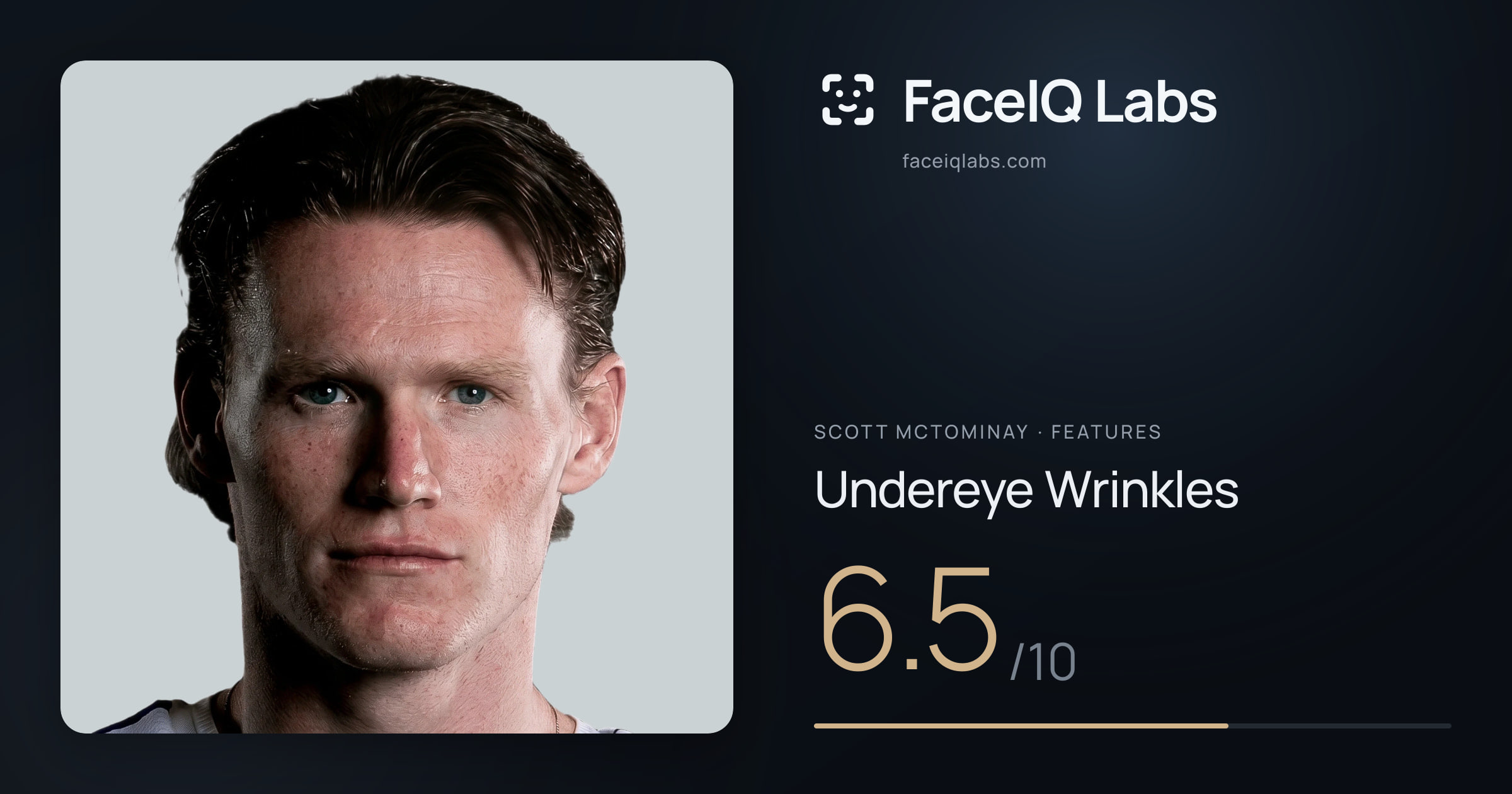 Scott Mctominay Undereye Wrinkles: 6.5/10, drawn on the photo