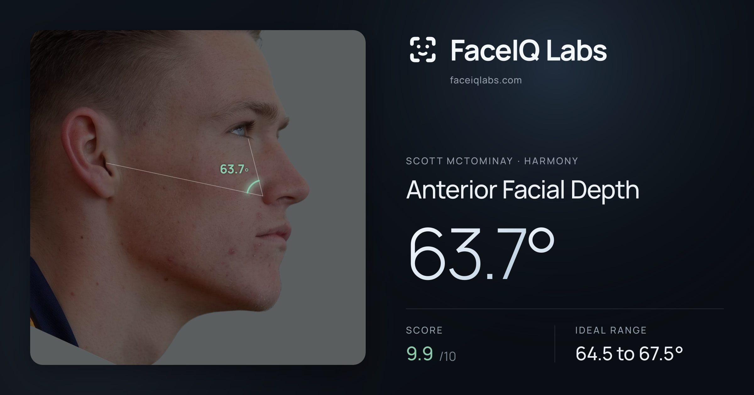Scott Mctominay Anterior Facial Depth: 63.7°, drawn on the photo