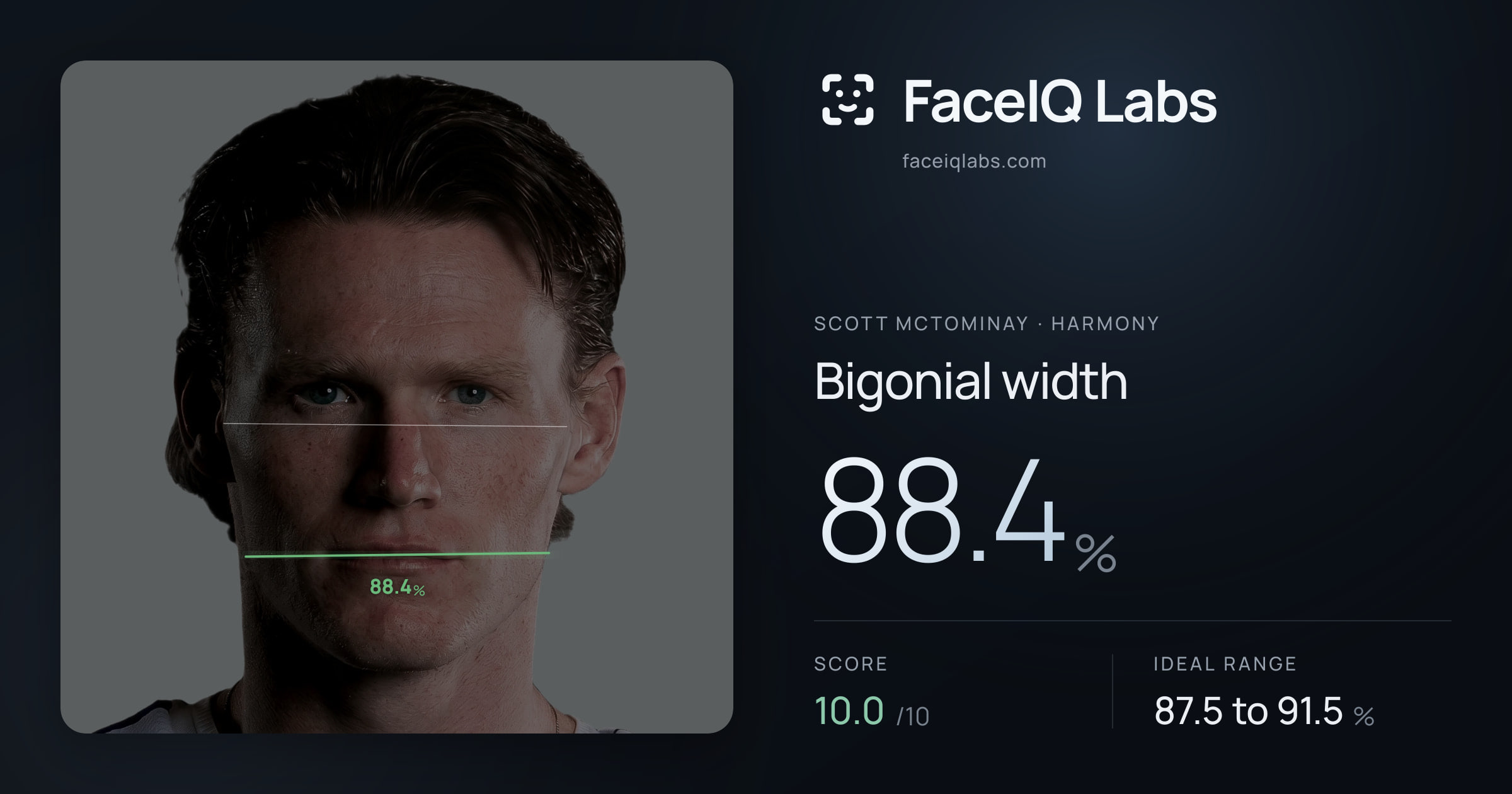 Scott Mctominay Bigonial width: 88.4%, drawn on the photo