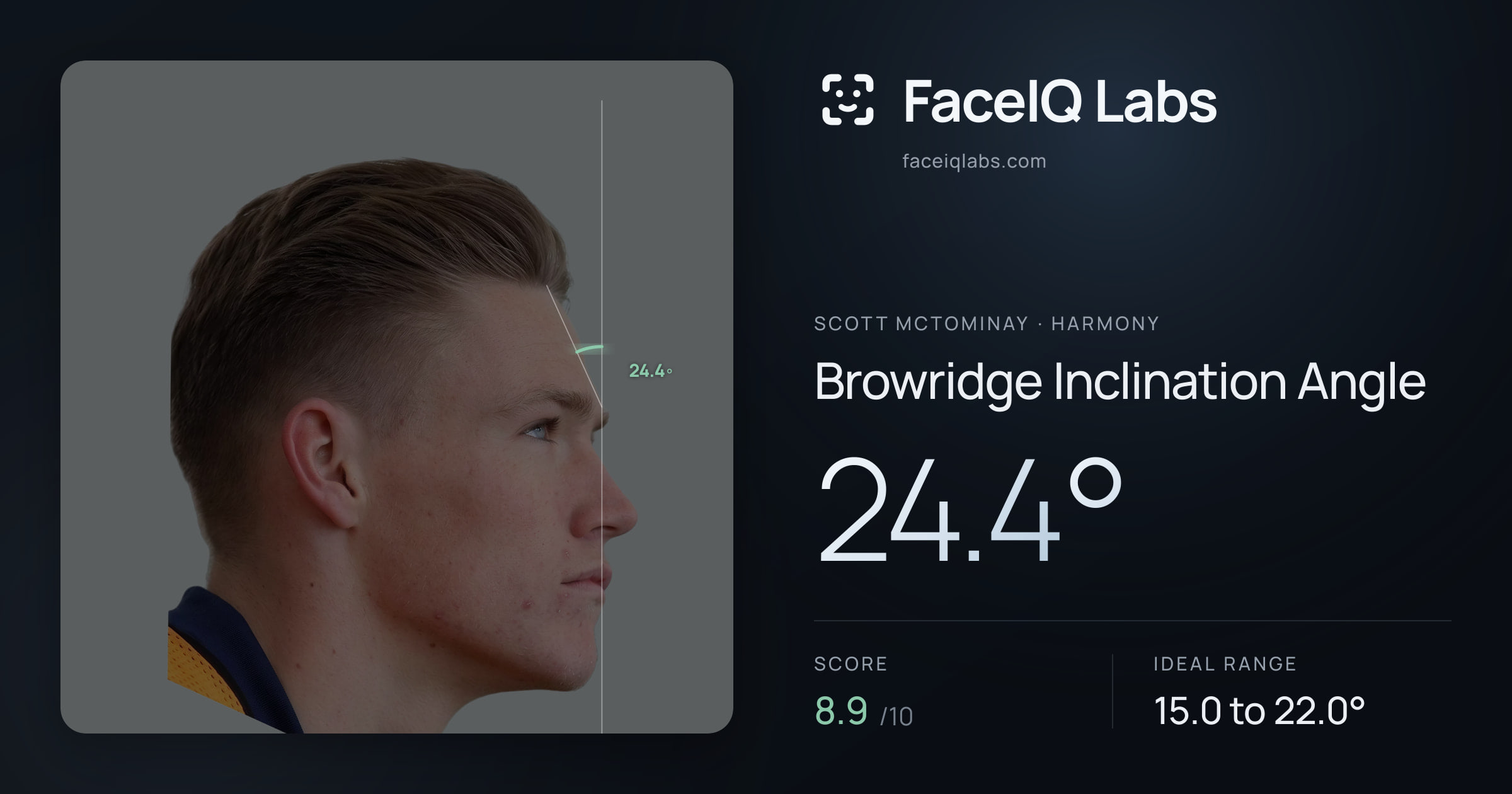Scott Mctominay Browridge Inclination Angle: 24.4°, drawn on the photo