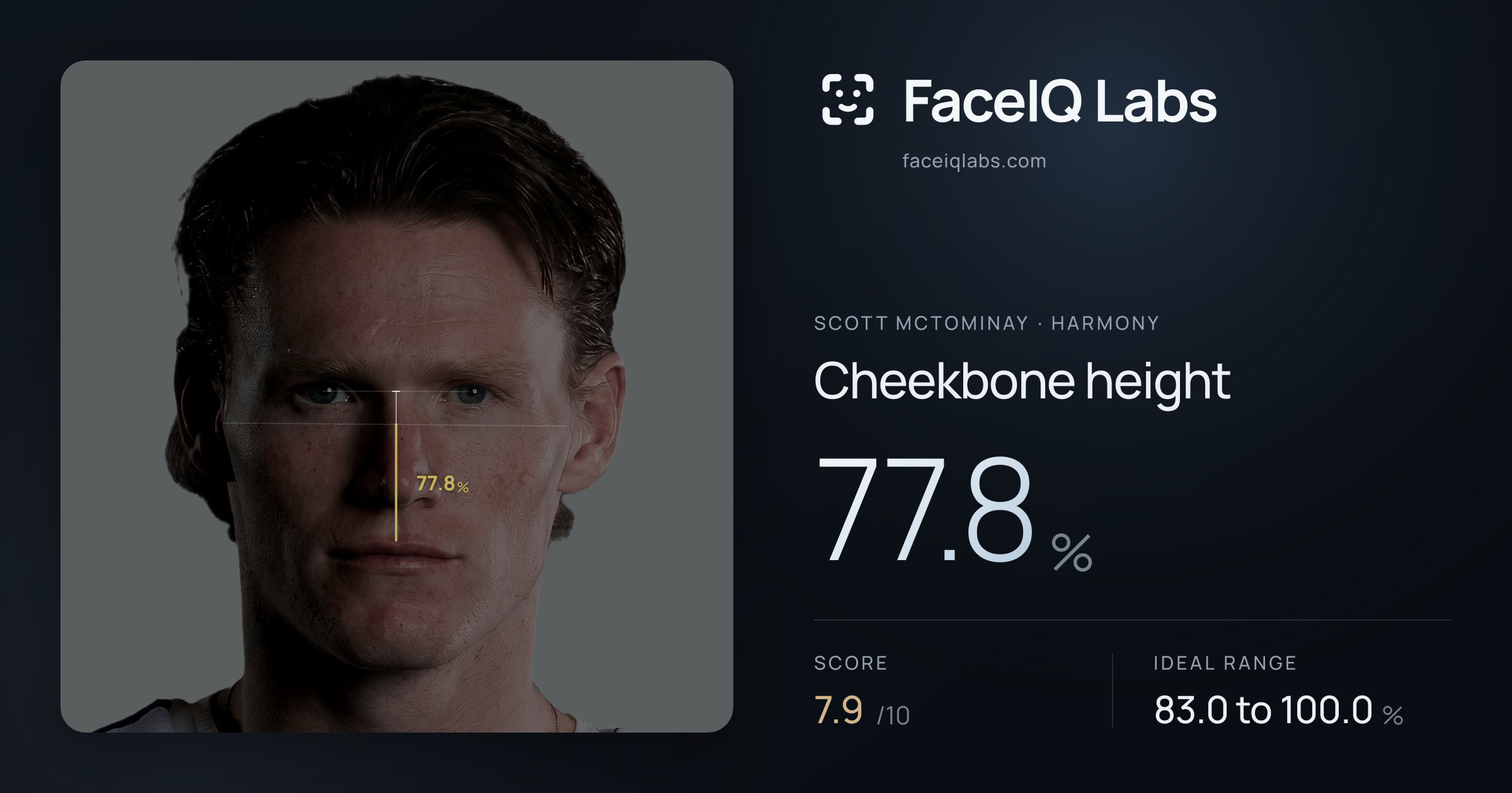 Scott Mctominay Cheekbone height: 77.8%, drawn on the photo