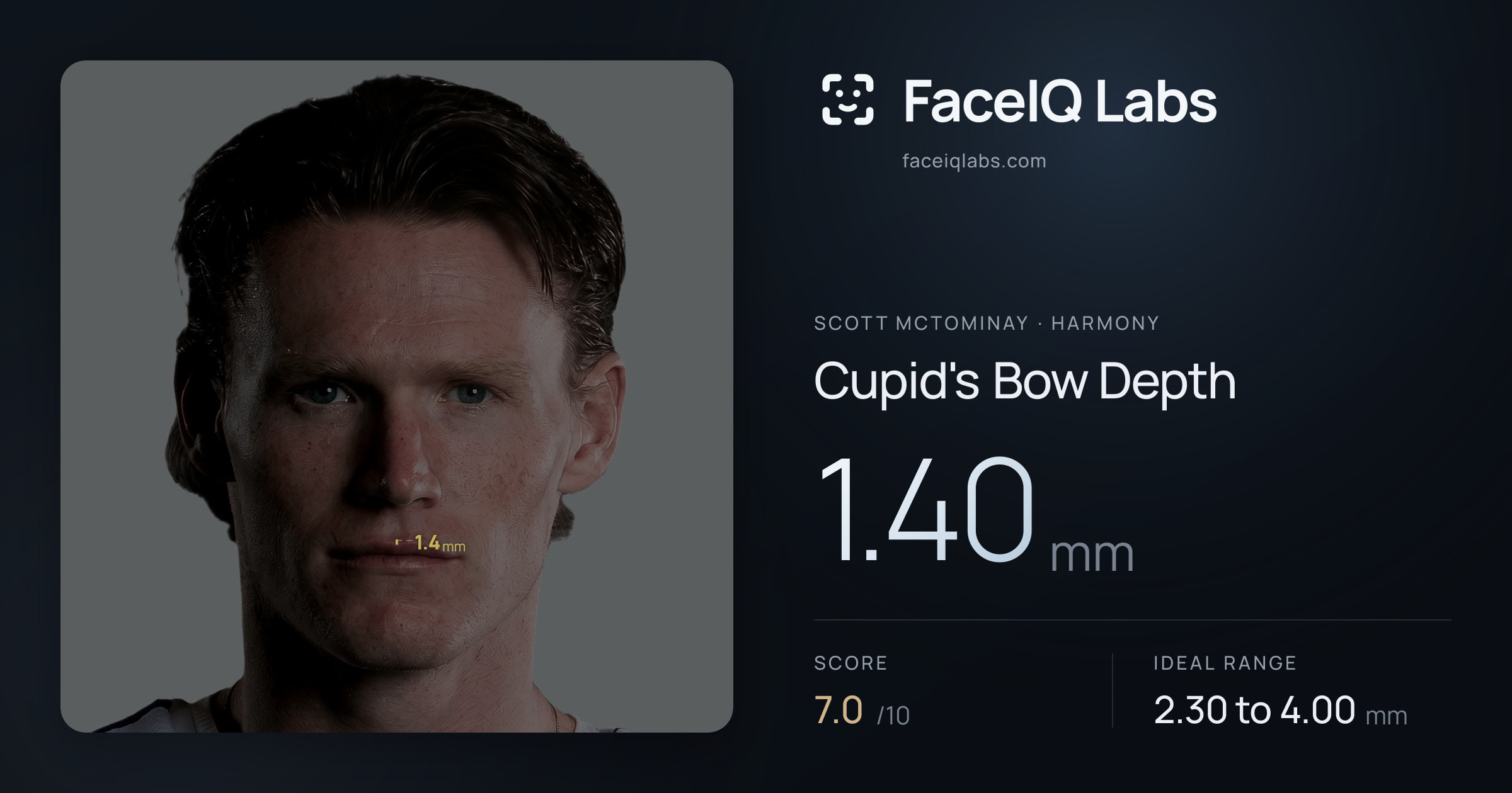 Scott Mctominay Cupid's Bow Depth: 1.40mm, drawn on the photo