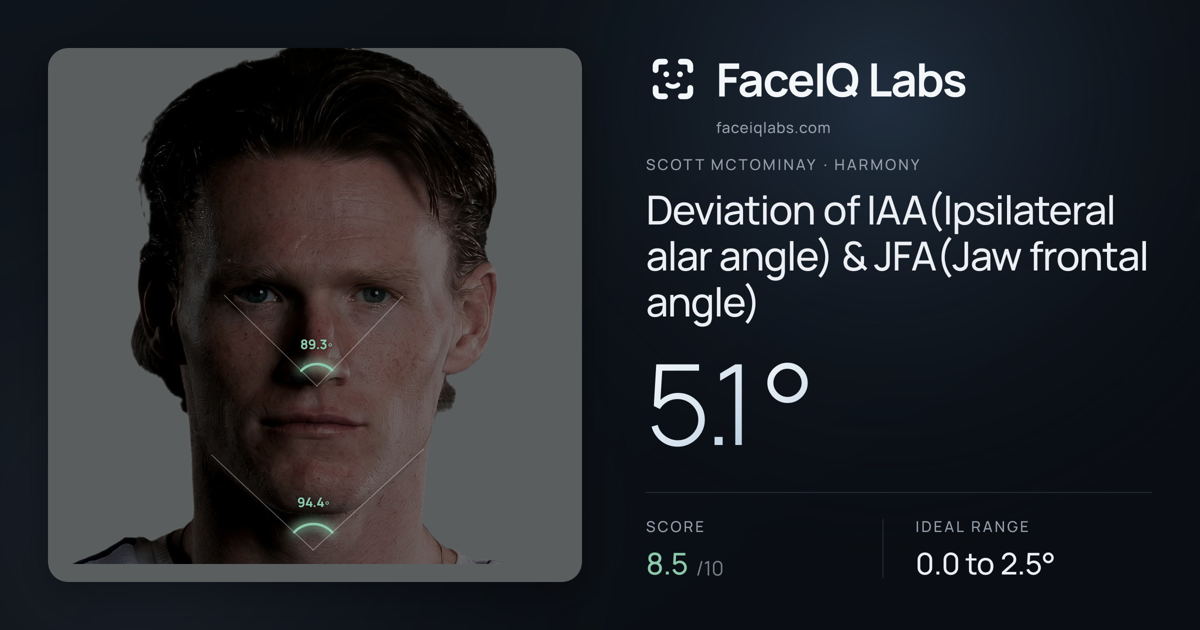 Scott Mctominay Deviation of IAA(Ipsilateral alar angle) & JFA(Jaw frontal angle): 5.1°, drawn on the photo