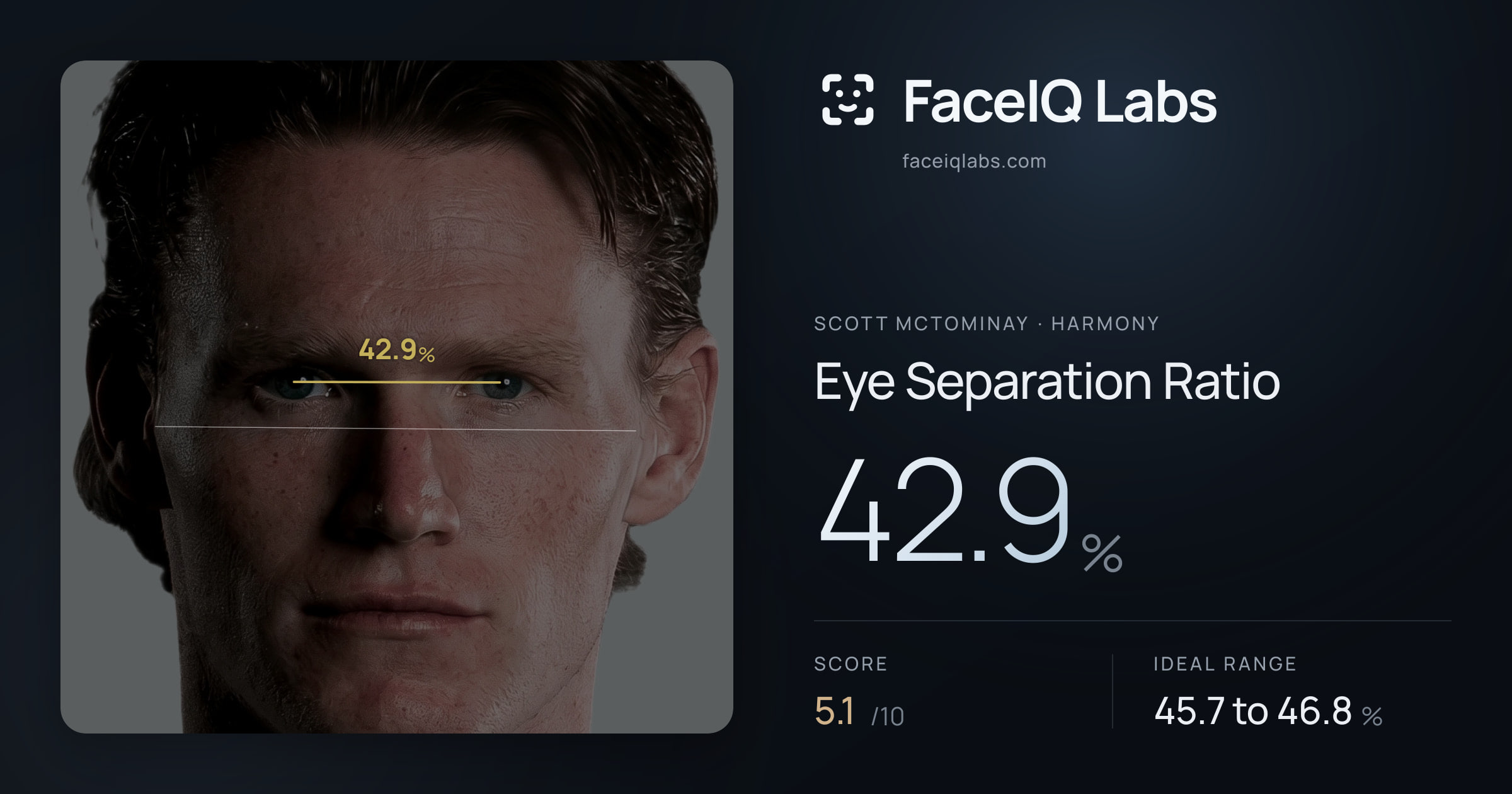 Scott Mctominay Eye Separation Ratio: 42.9%, drawn on the photo