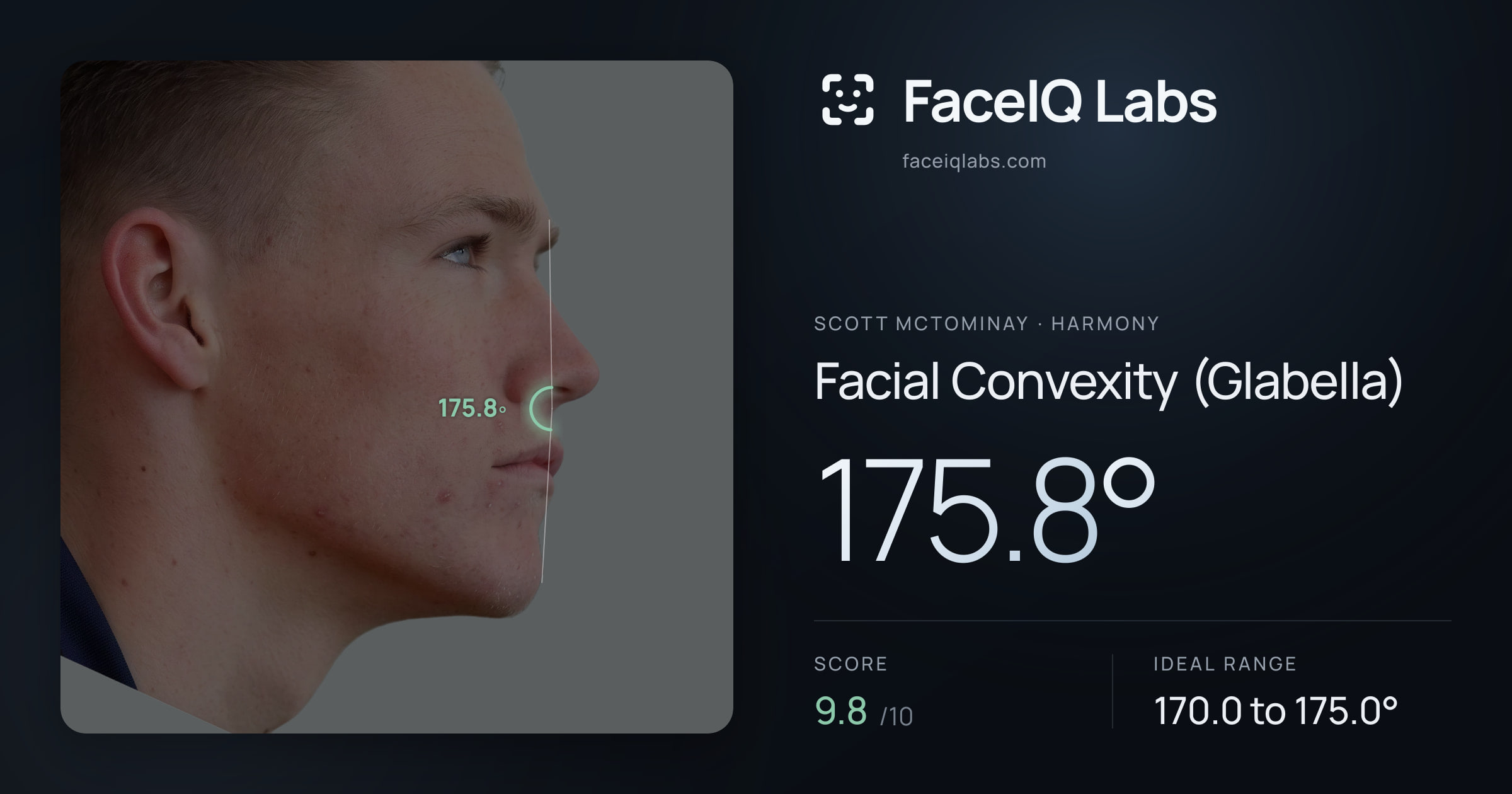 Scott Mctominay Facial Convexity (Glabella): 175.8°, drawn on the photo