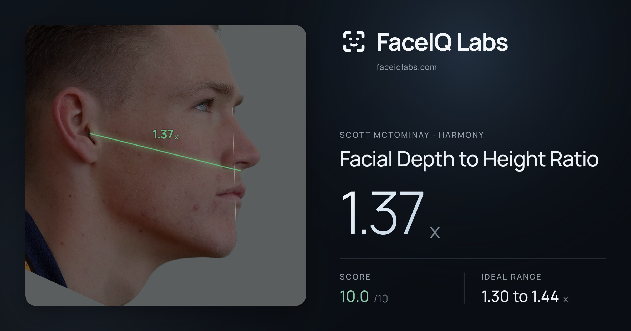 Scott Mctominay Facial Depth to Height Ratio: 1.37x, drawn on the photo