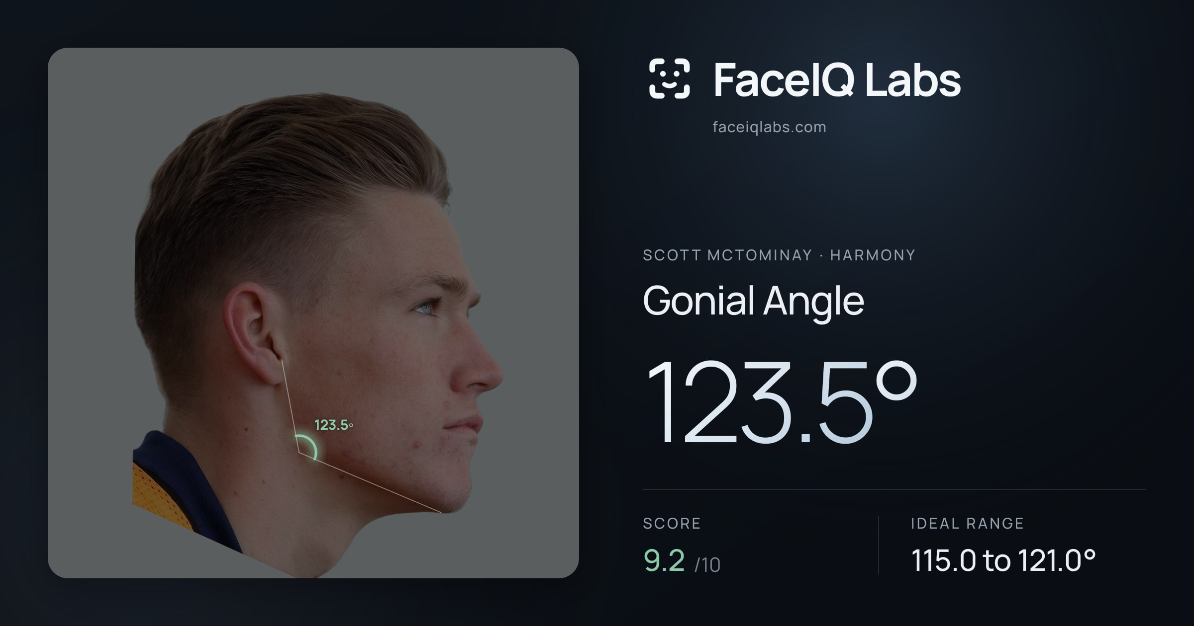 Scott Mctominay Gonial Angle: 123.5°, drawn on the photo