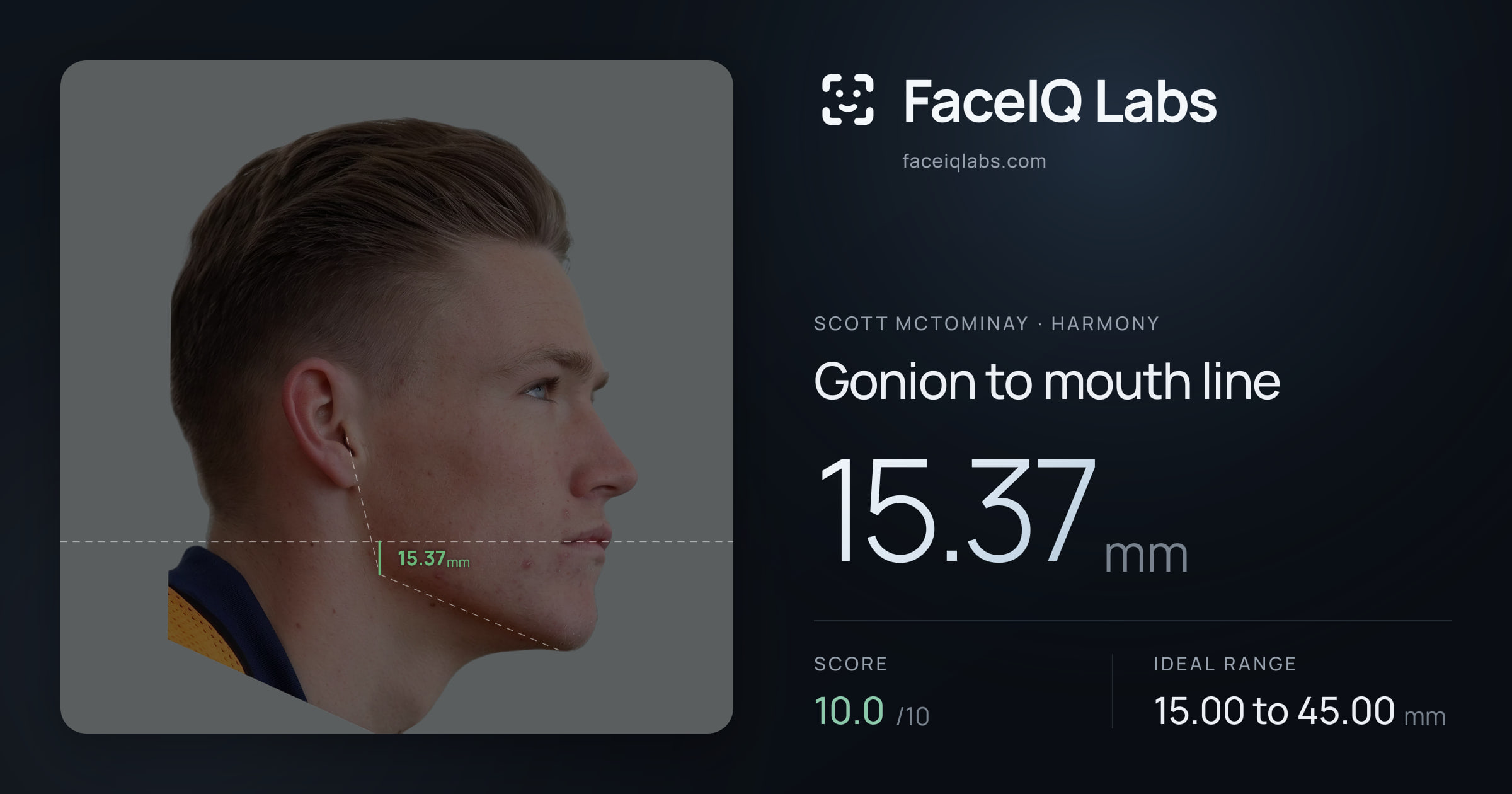 Scott Mctominay Gonion to mouth line: 15.37mm, drawn on the photo
