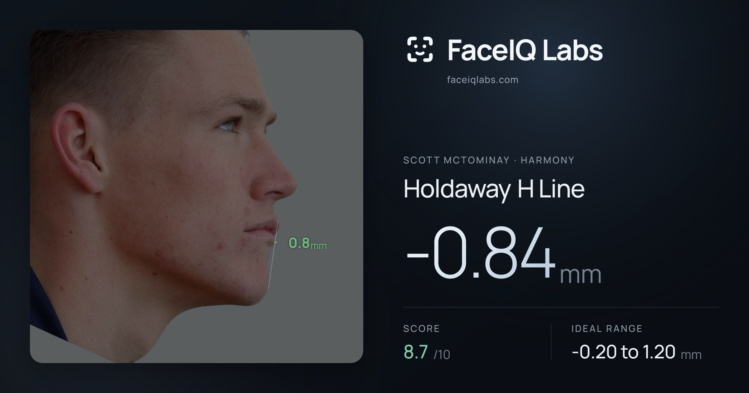 Scott Mctominay Holdaway H Line: -0.84mm, drawn on the photo