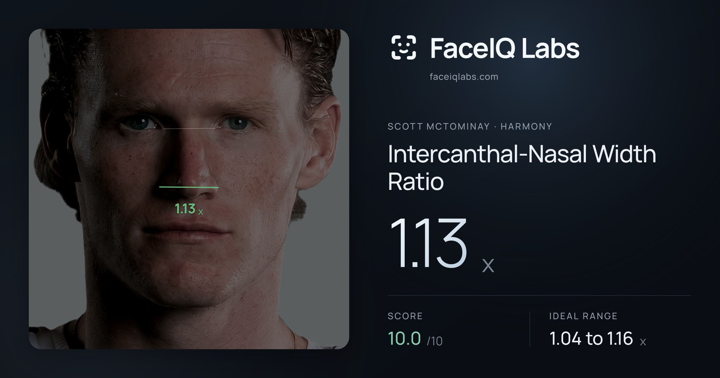 Scott Mctominay Intercanthal-Nasal Width Ratio: 1.13x, drawn on the photo