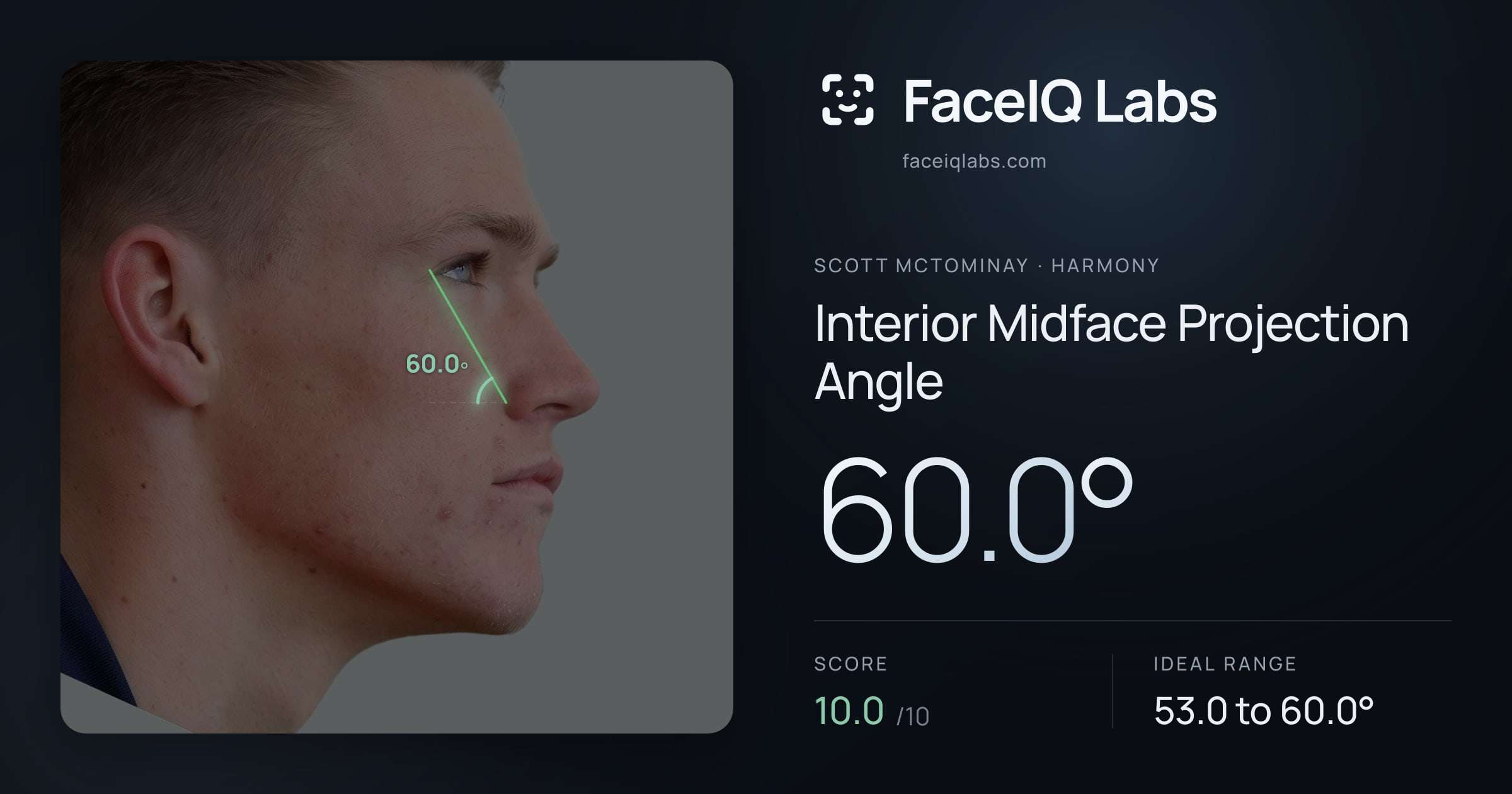 Scott Mctominay Interior Midface Projection Angle: 60.0°, drawn on the photo