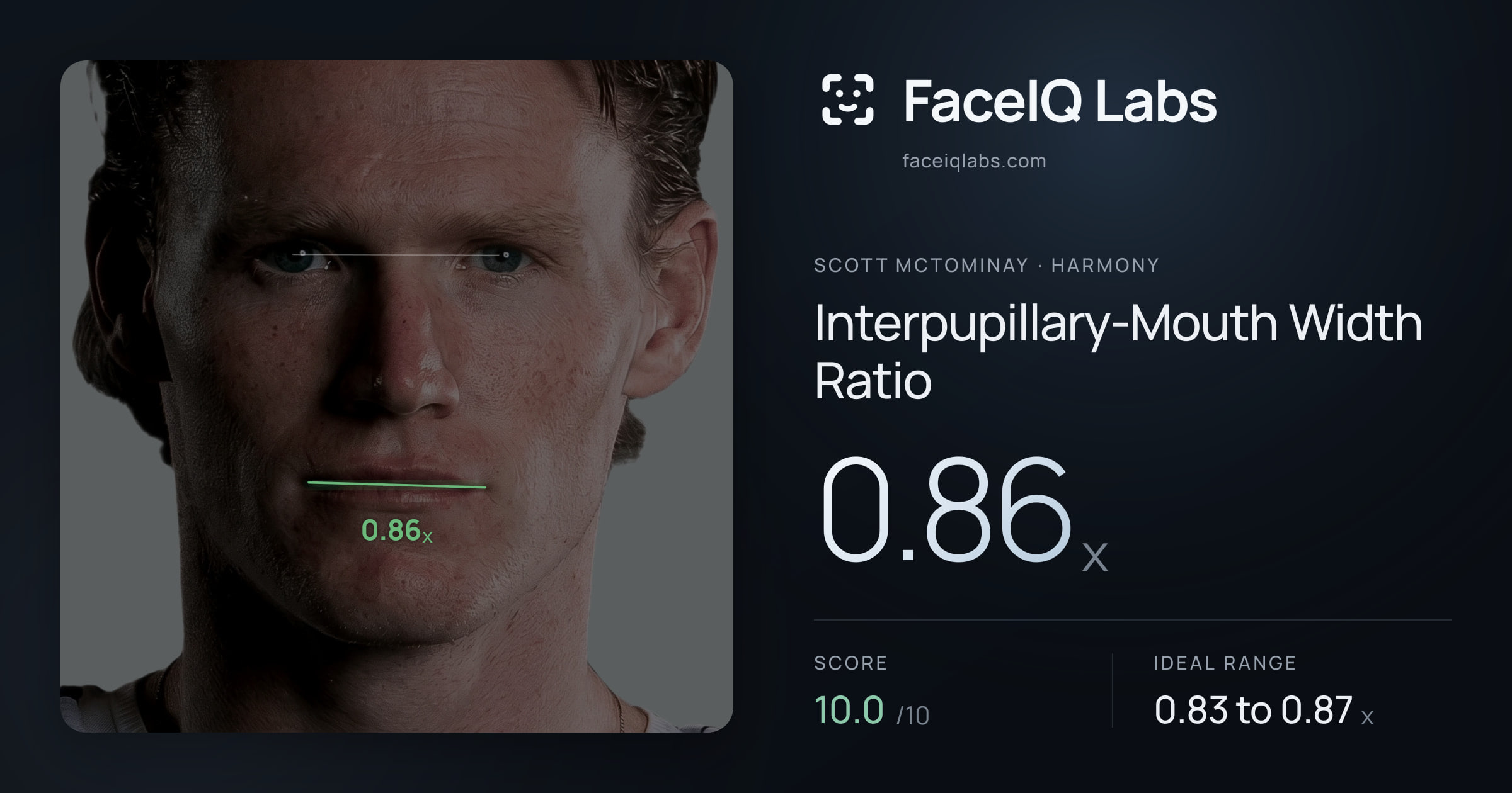 Scott Mctominay Interpupillary-Mouth Width Ratio: 0.86x, drawn on the photo