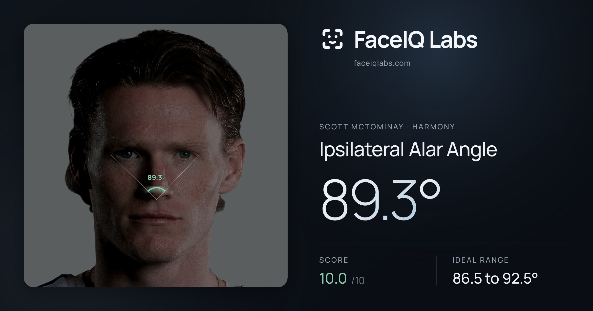 Scott Mctominay Ipsilateral Alar Angle: 89.3°, drawn on the photo